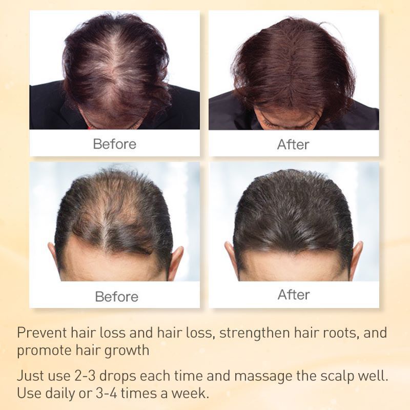 Natural Ginger Hair Growth Oil Prevent Hair Loss Essential Oil Smoothing Repair Damaged Hair Growth Products for Men Women Hair Care 35ml