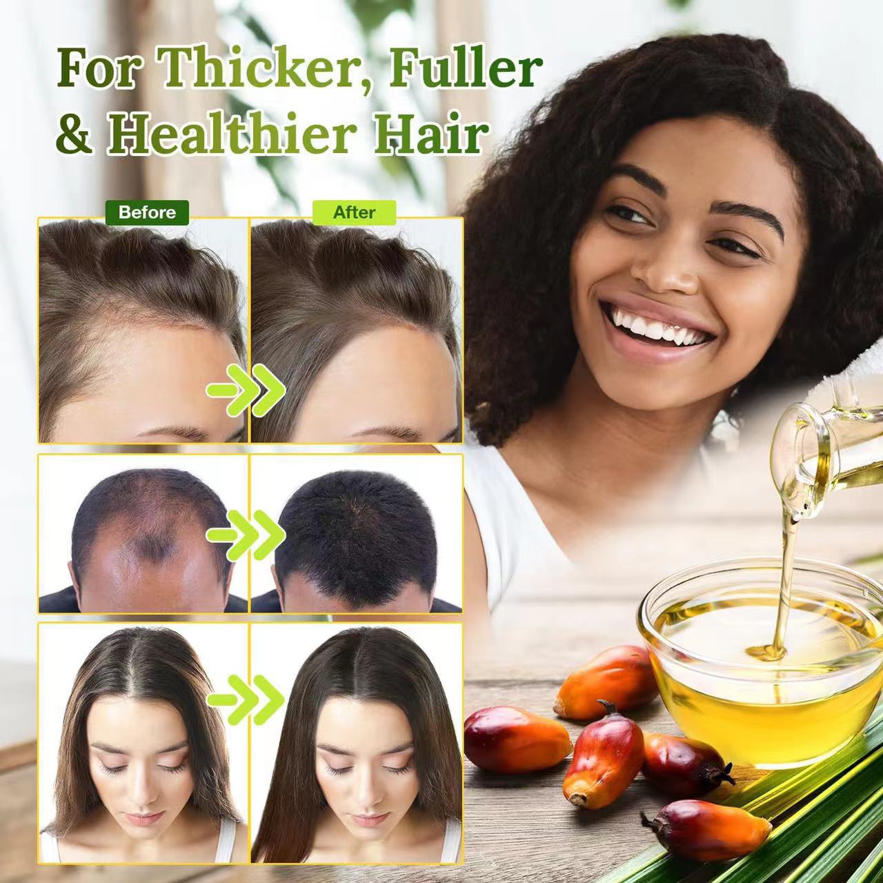 Batana Oil Advanced Essential Oil for Hair Growth Skin Care Stimulates Hair Growth Moisturizes Hair Scalp Strengthens Hair Care Nourishing Scalp 60ml