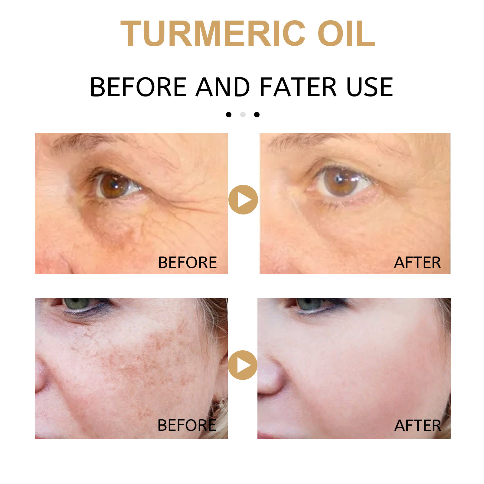 Turmeric Face Serum Freckle Shrink Pore Essence Repair Melanin Brighten Moisturizing Nourish Cur-cumin Oil Fade Dark Spot Anti Aging Essential Skin Care