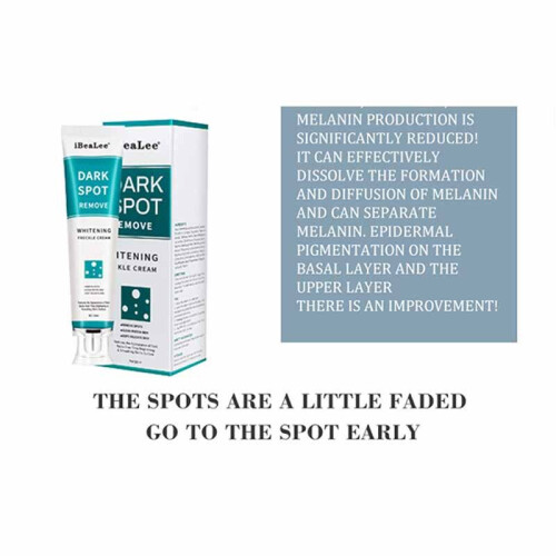Whitening Freckle Cream Remove Melasma Acne Dark Spot Skin Care 20ml