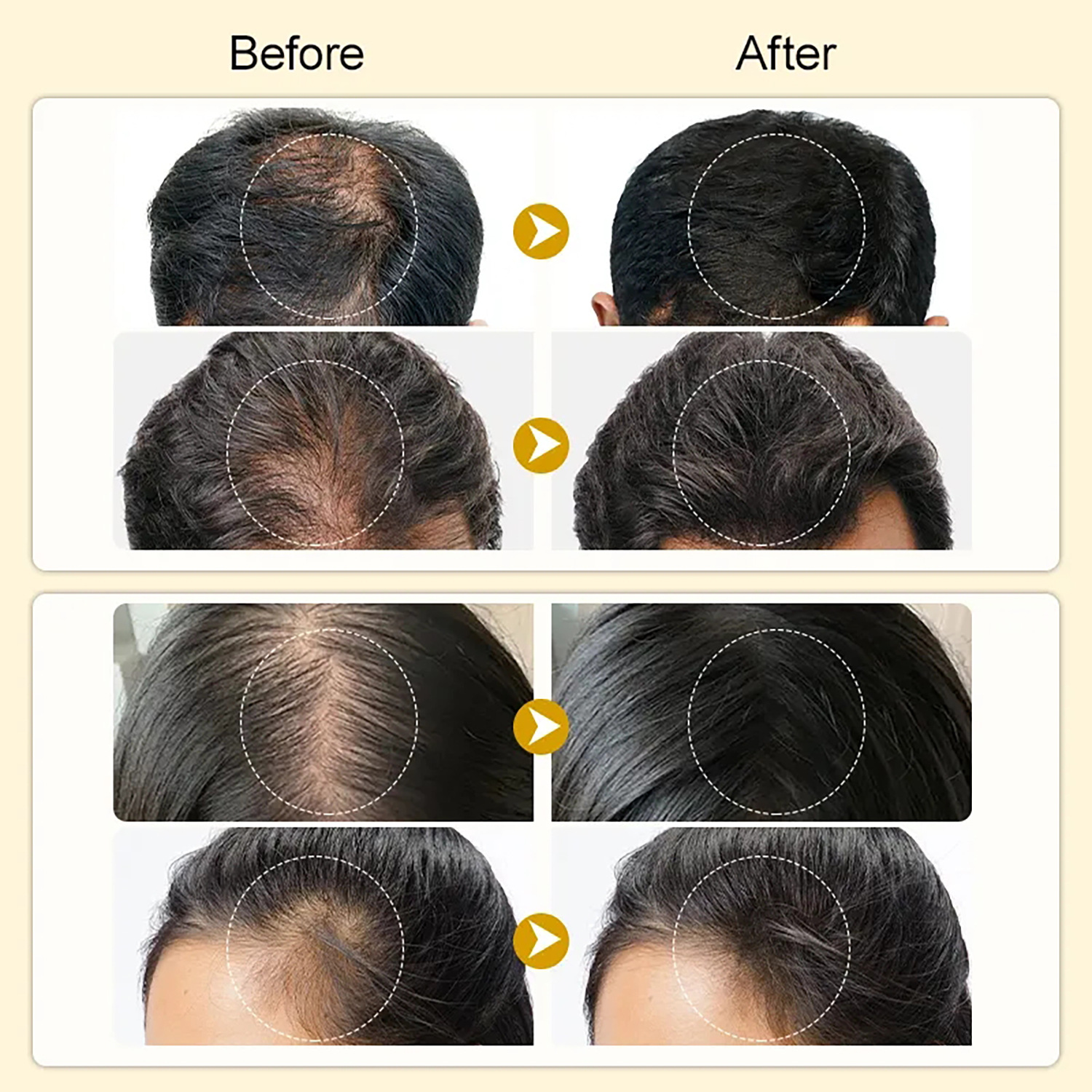 Black Sesame Hair Growth Essence Strengthening and Moisturizing Hair Root Repair Improves Anti Hair Loss and Hair Retention Dense Hair Essential Oil 30ml