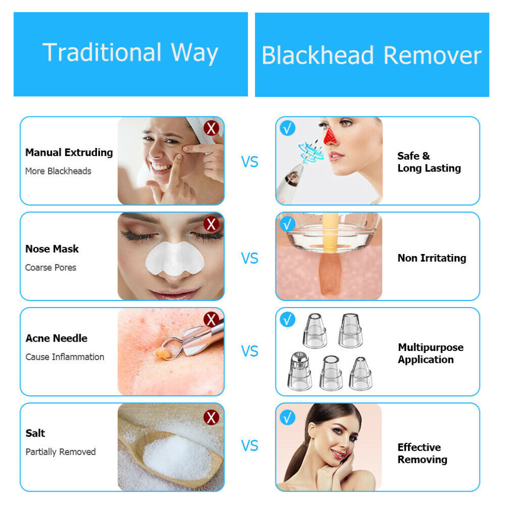 Blackhead Remover Wifi Cam Pore Vacuum Suction Face Nose Acne Cleaner