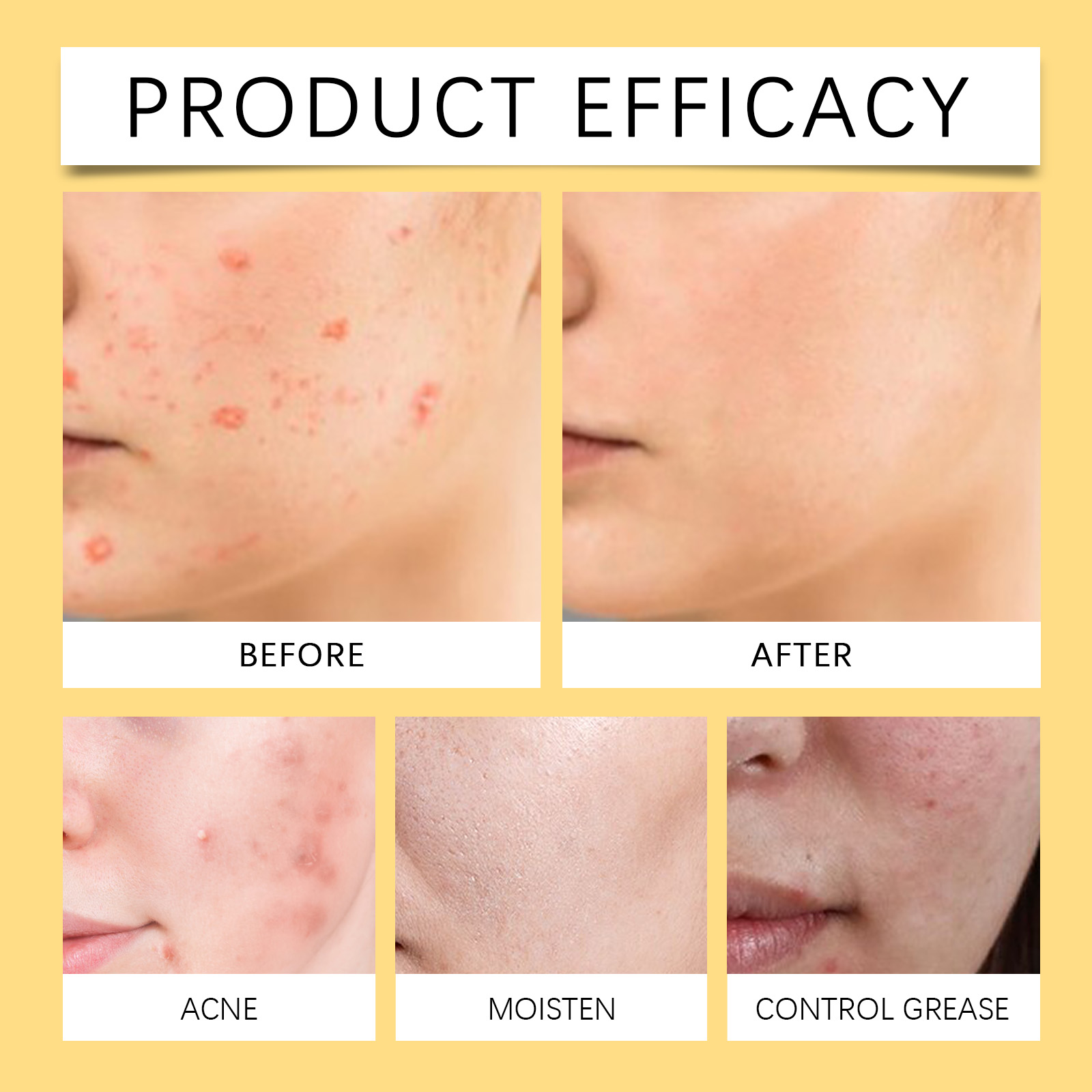 Skin Soothing Care Cream Herbal Plant Mild Formula Clean Calm Skin Fade Blemish Mole Treatment