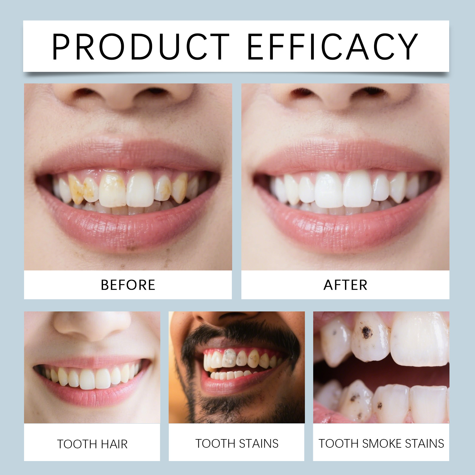 Dental Care Essence Liquid Clean Tooth Surface Reduce Tooth Stains Natural Gloss Gentle Maintain Oral Long Lasting Fresh