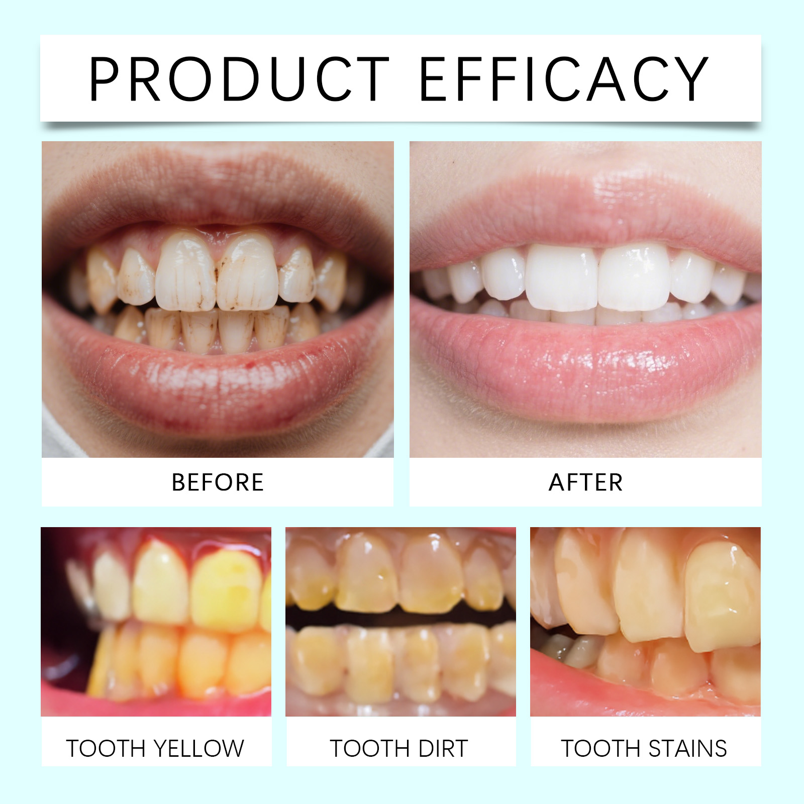Teeth Cleaning Mousse Mild Cleansing Protect Teeth Purify Daily Comfort Oral Fresh Care Remove Stains