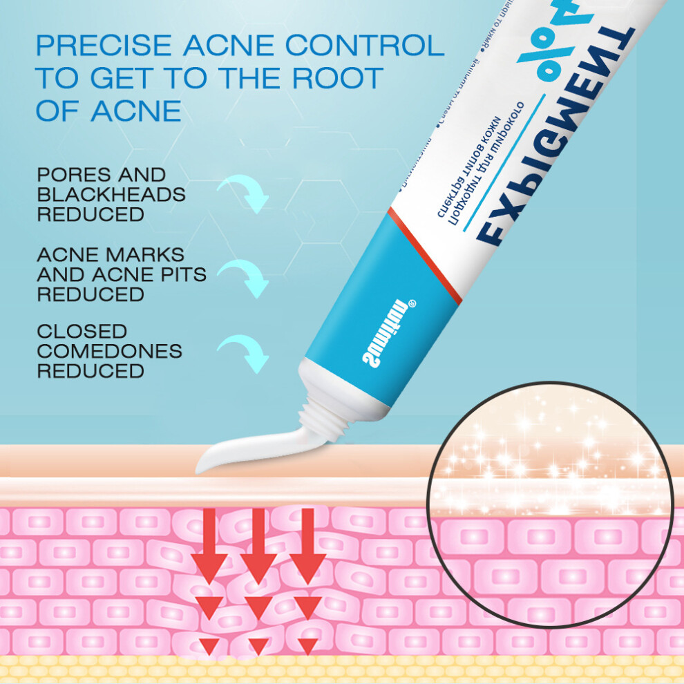 20g External skin care cream acne skin cream skincare
