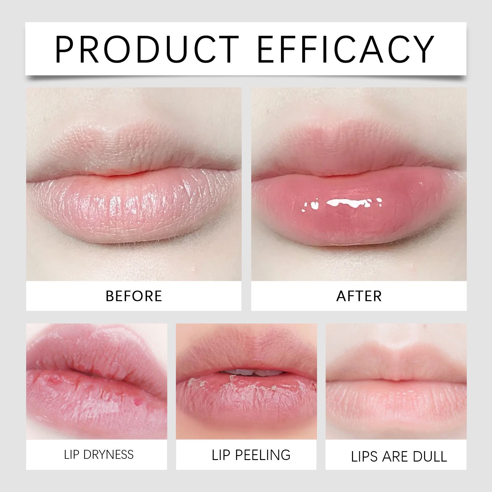 Moisturizing Lip Oil Hydrating Plumping For Dry Lips Daily Lip Care Treatment
