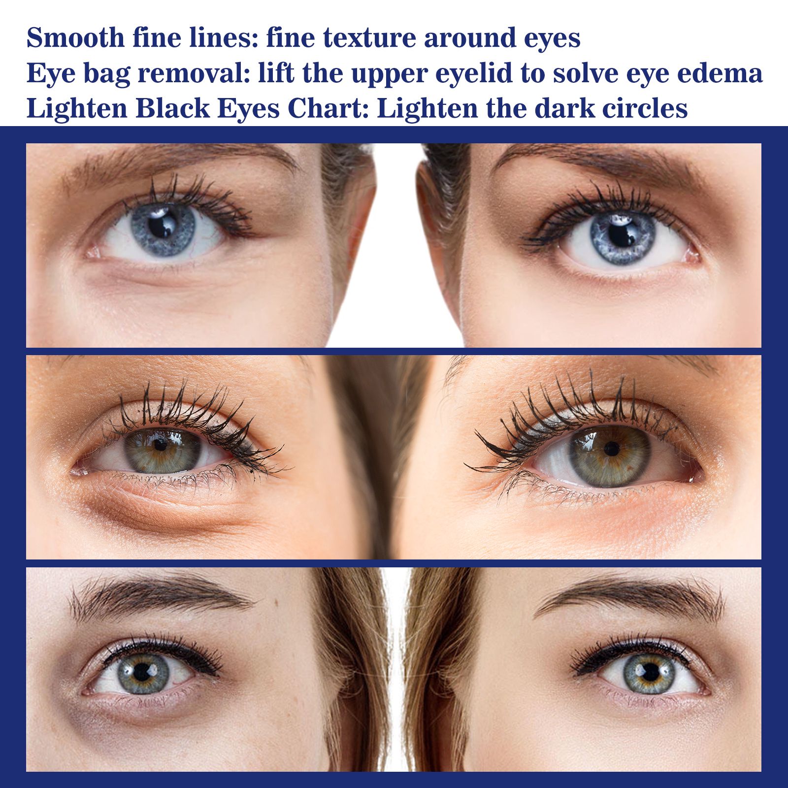 Active Eye Cream Anti Wrinkle Firming For Dark Circles Puffiness And Fine Lines 30ml