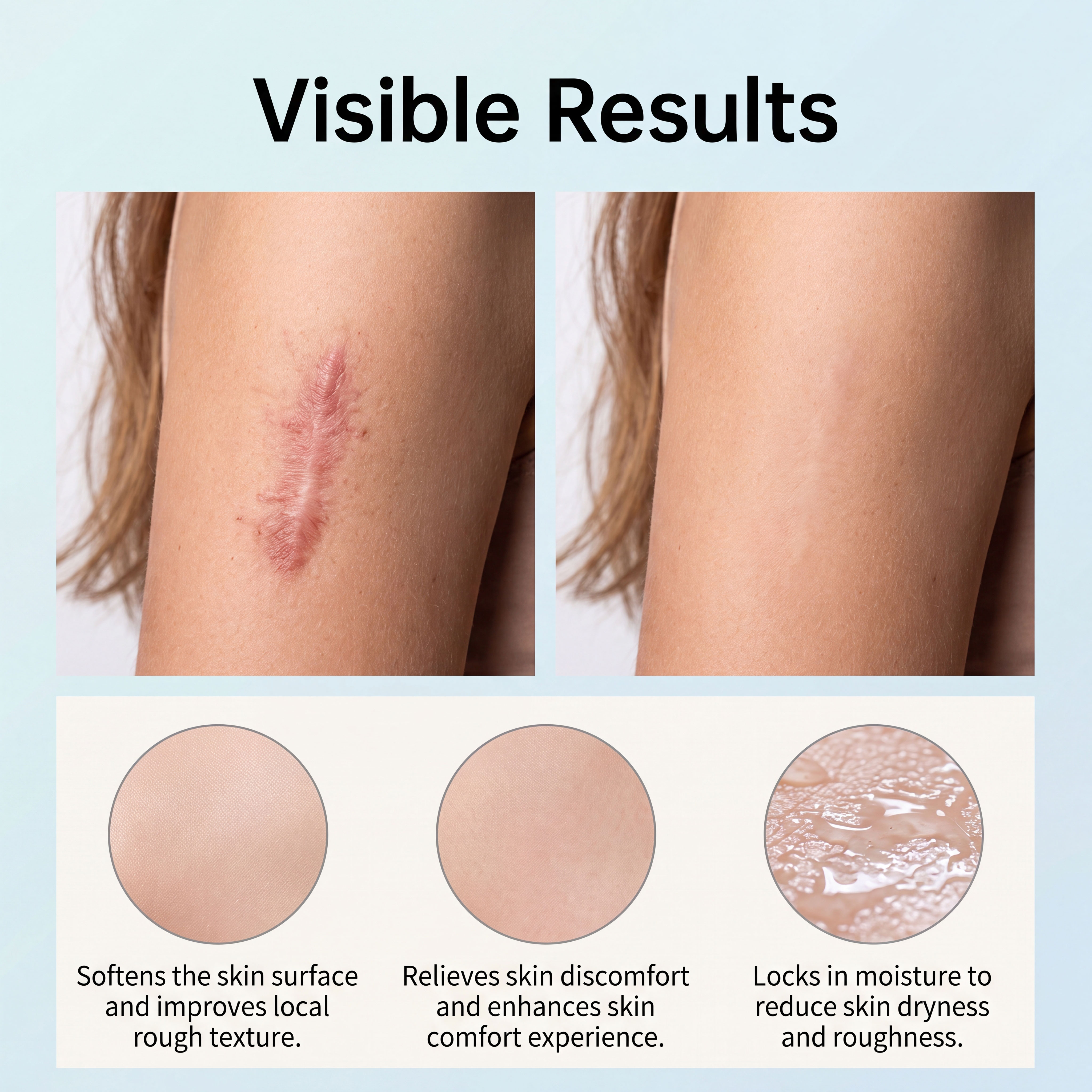 Skin Care Patch Silicone Material Skin Friendly Waterproof Breathable Smooth Protection Cuttable For Skin Treatment