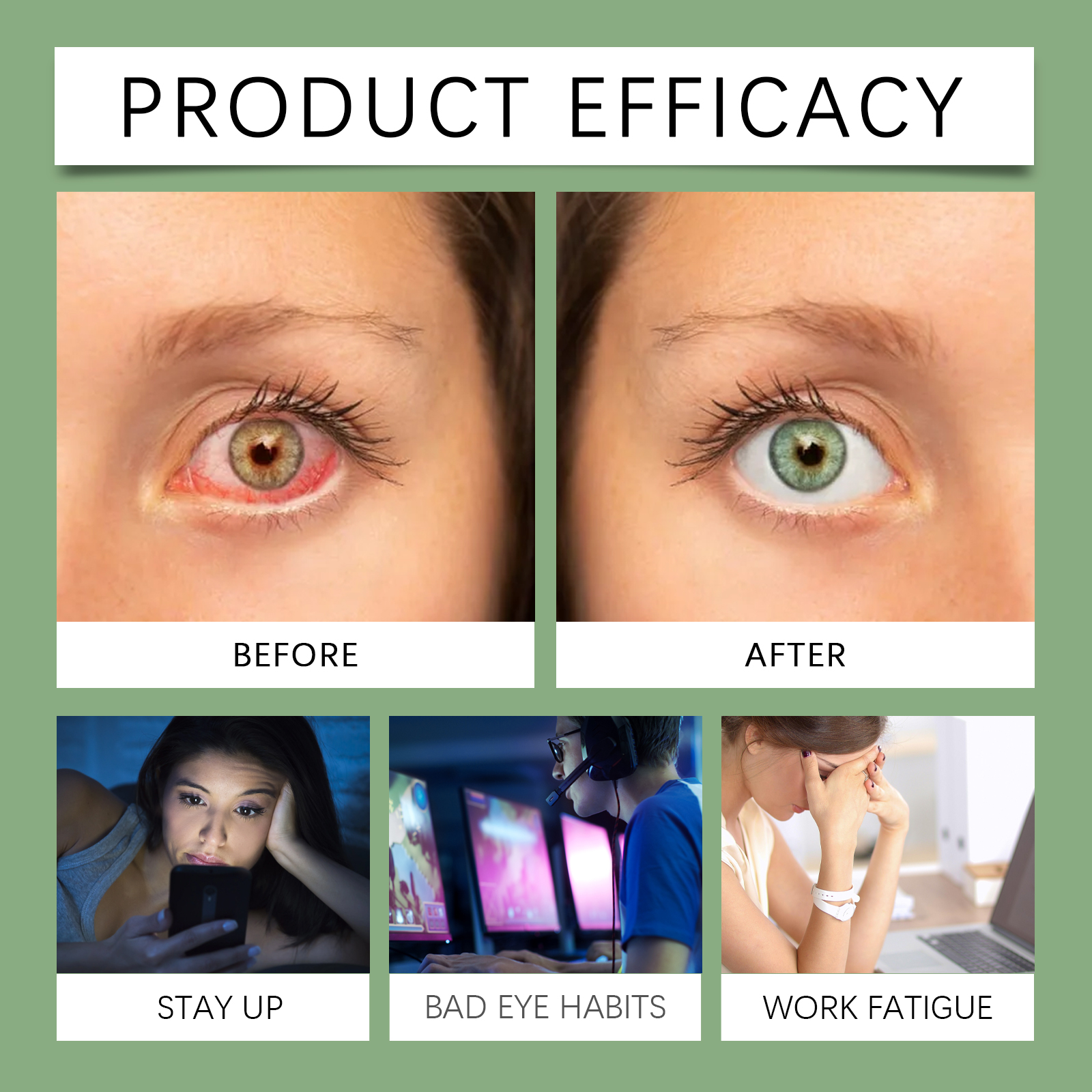 Eye Care Drops Hydrating Moisturizing Gentle Nourishing Relieving Dry Eye Skin Care Liquid