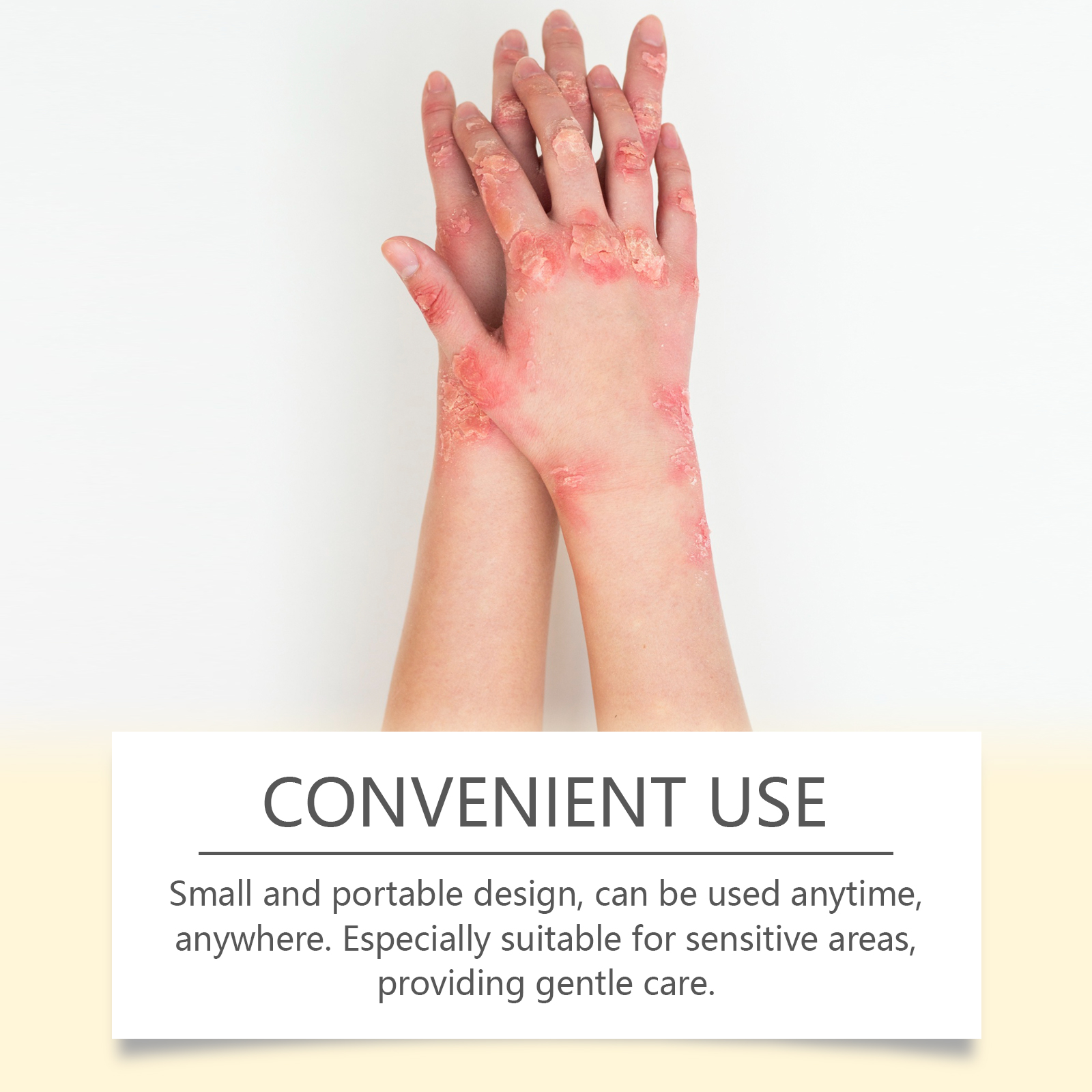Bee Venom Skin Care Cream Gentle Nourish Relieve Dry Discomfort Skin Body Care Lotion