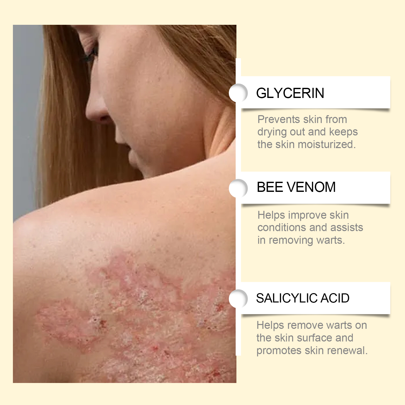 Bee Venom Skin Care Cream Gentle Nourish Relieve Dry Discomfort Skin Body Care Lotion