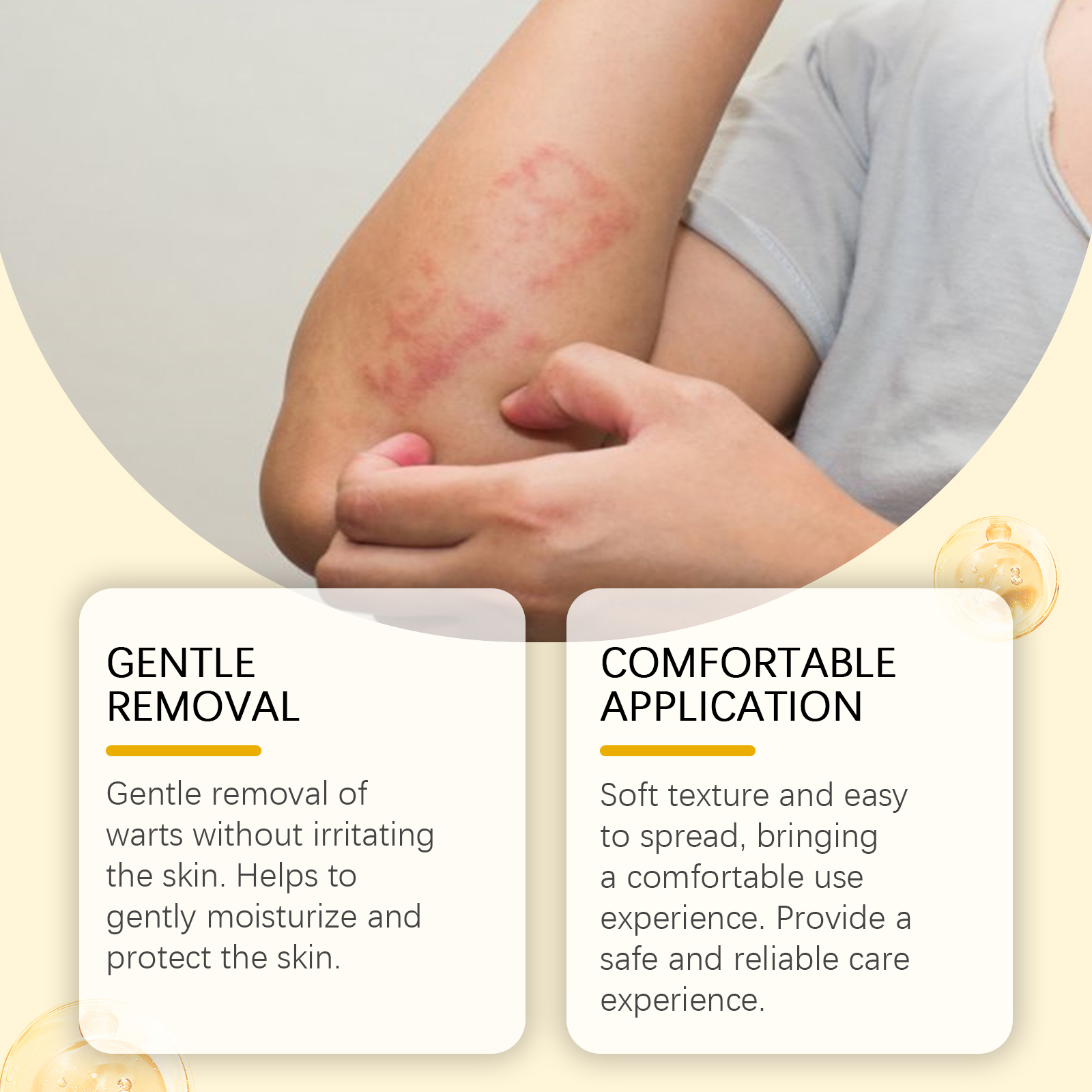 Bee Venom Skin Care Cream Gentle Nourish Relieve Dry Discomfort Skin Body Care Lotion