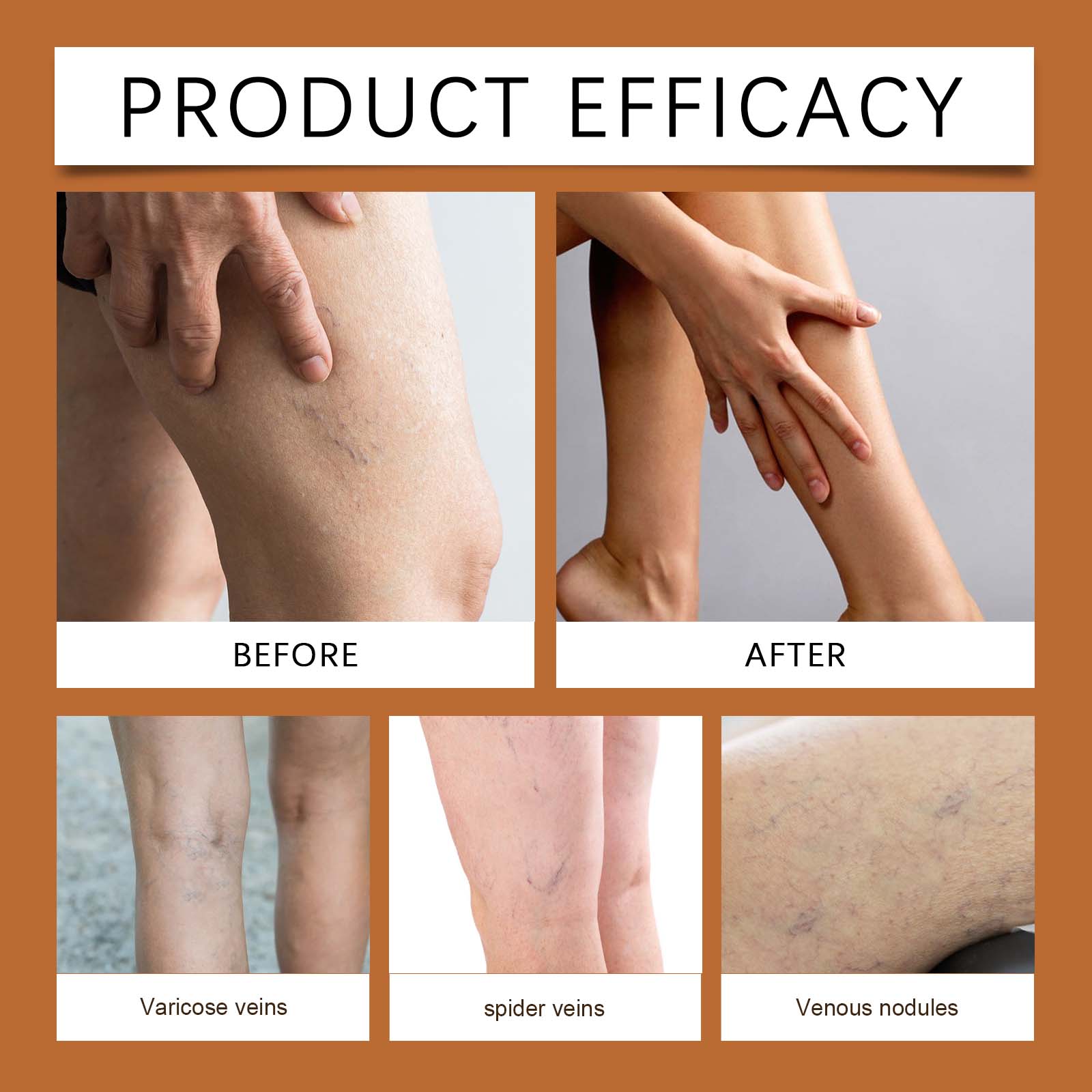 Leg Light Cream Daily Nourishing Refreshing Non Sticky Mild Care Soft Massage Gentle External Skin