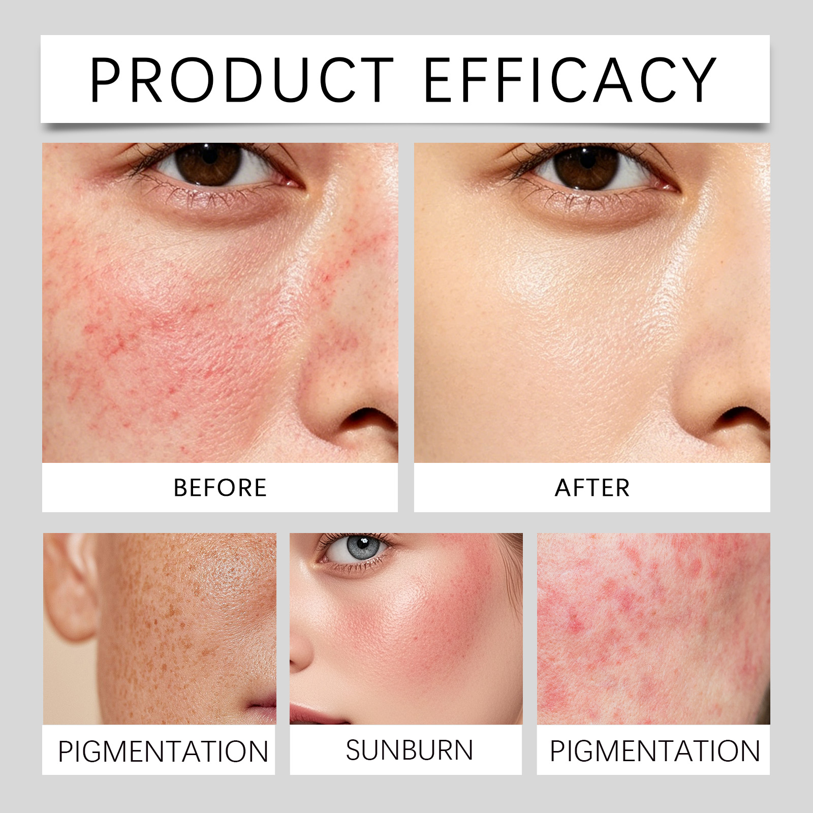 Rice Extract Probiotic Hydrating Protection Cream Lightweight Absorbable Nourishing Skin Gentle Comfort Summer Outdoor Care