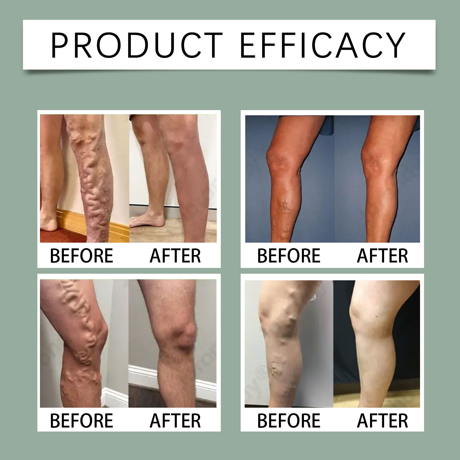 Leg Care Patch Daily Gentle Moisturizing Nourishing External Skin Relief Calming Leg Skincare Sticker
