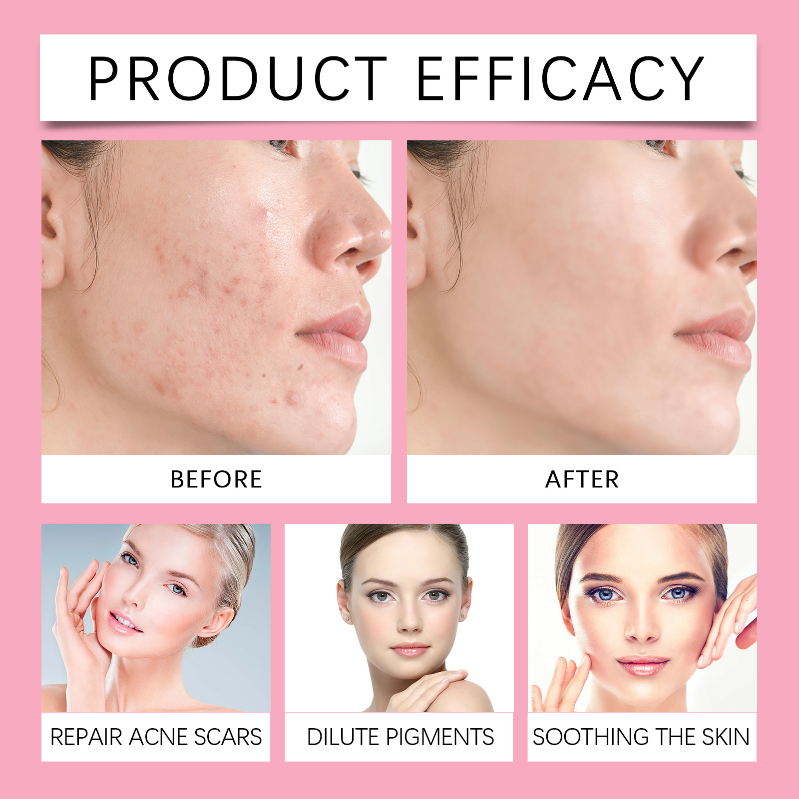 Facial Care Essence Cream Herbal Ingredients Mild Comfort Clean Facial Acne Skin Delicate Smooth