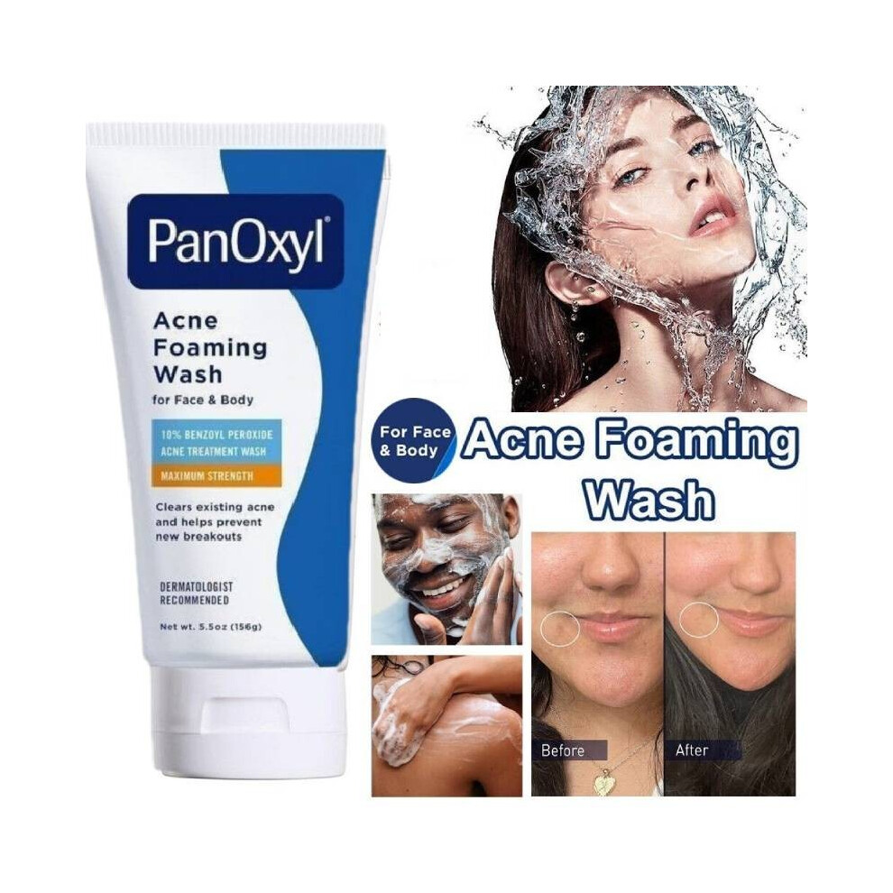 Foaming Wash Acne Face Body Facial Cleanser 10 Percent Active Oil Ingredient Control