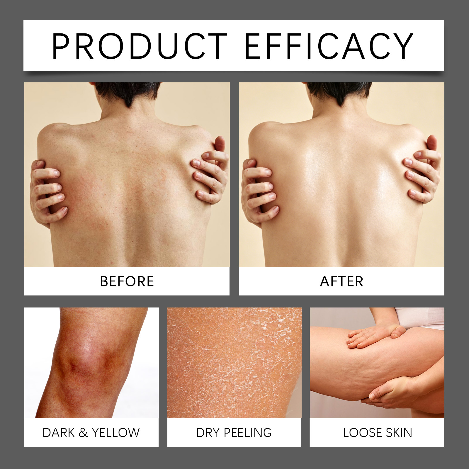 Retinol Skin Renewing Body Lotion Mild Formula Nourish Skin Light Texture Moisturize Daily Body Care