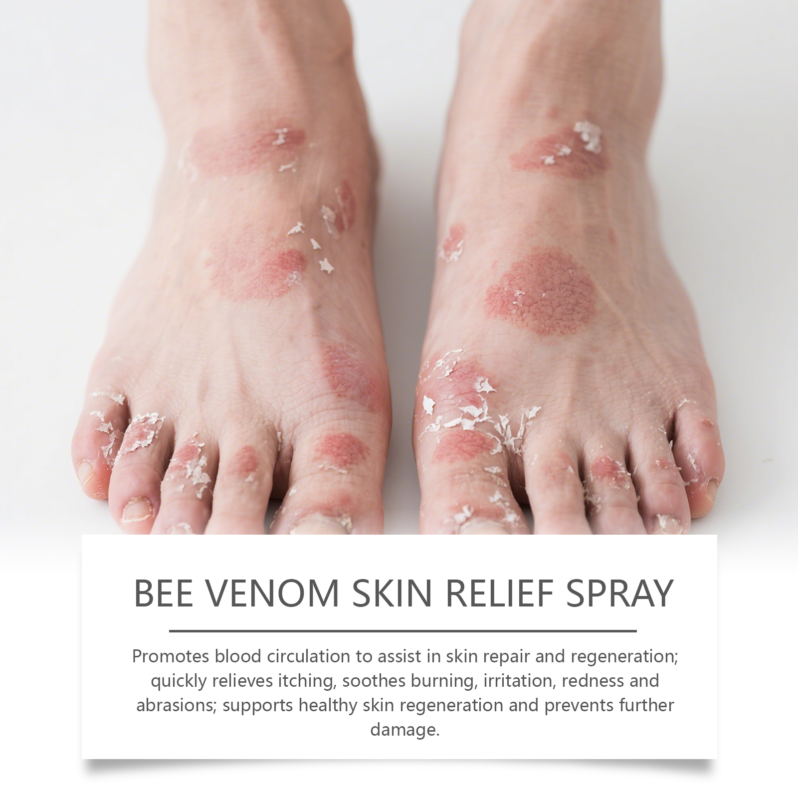 Soothe Skin Spray Soft Mild Hydrating Moisturizing Cleansing Comfort Bee Venom Care Body Complexion