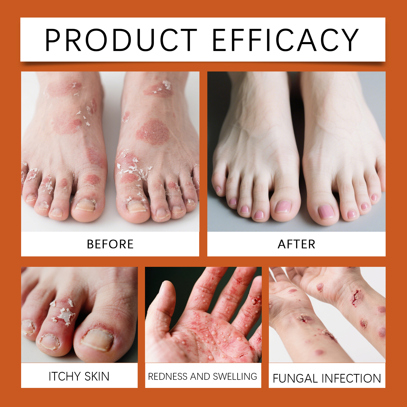 Soothe Skin Spray Soft Mild Hydrating Moisturizing Cleansing Comfort Bee Venom Care Body Complexion