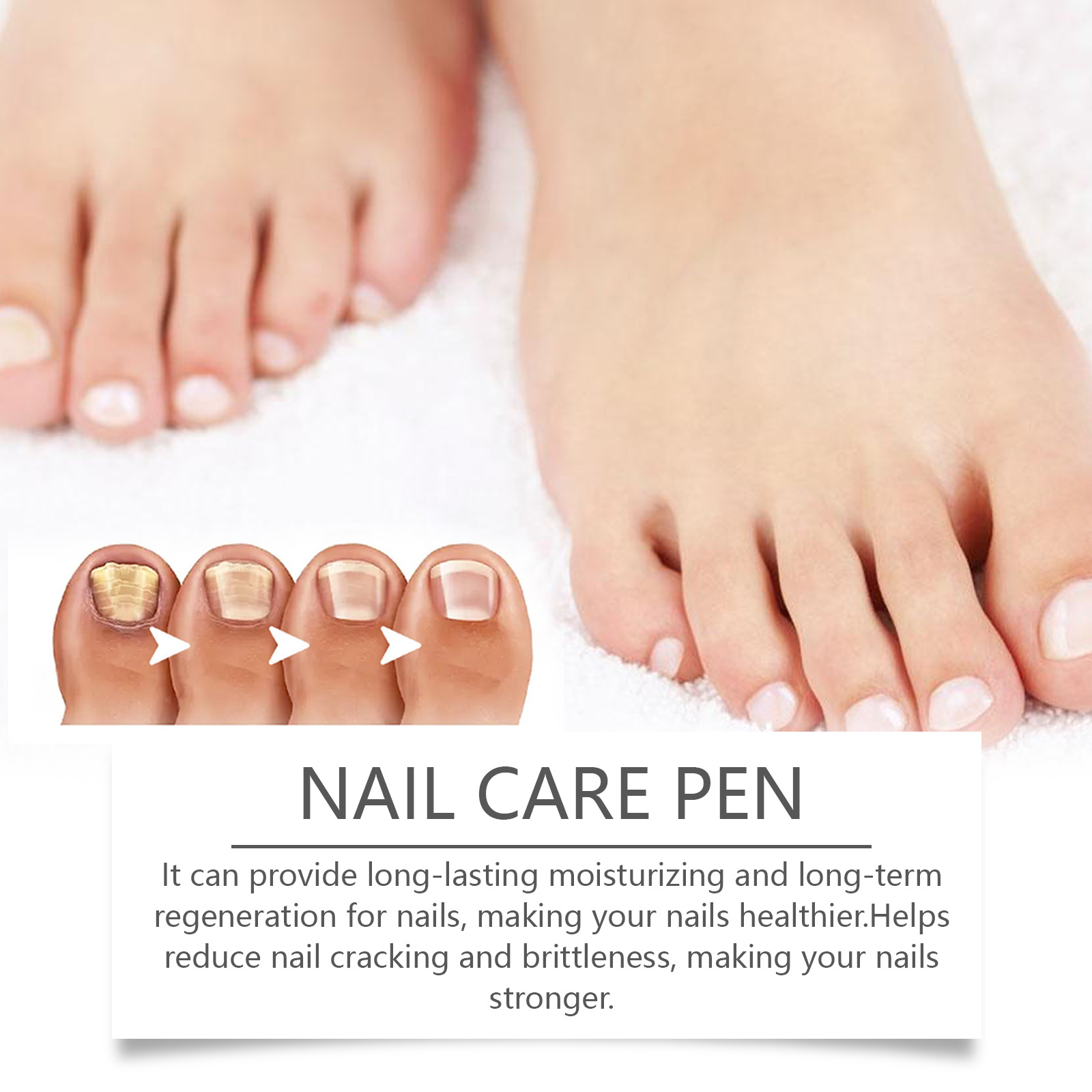 Nail Care Pen Gentle Care Nutrition Care Bright Nails For Hand Foot Thick Toenails