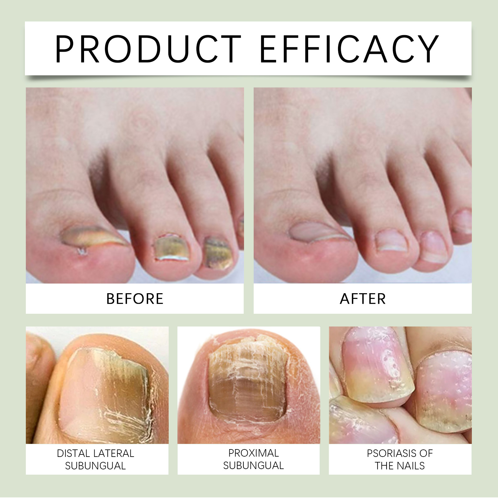 Nail Care Pen Gentle Care Nutrition Care Bright Nails For Hand Foot Thick Toenails