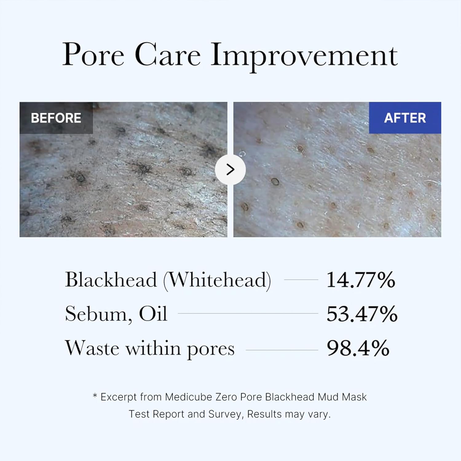 medicube Zero Pore Blackhead Mud Facial Mask Skin Cooling Pore Tightening 3 Minute Quick Dry Formula with AHA BHA PHA Pore Purifying Clay Korean Mud Mask 100g