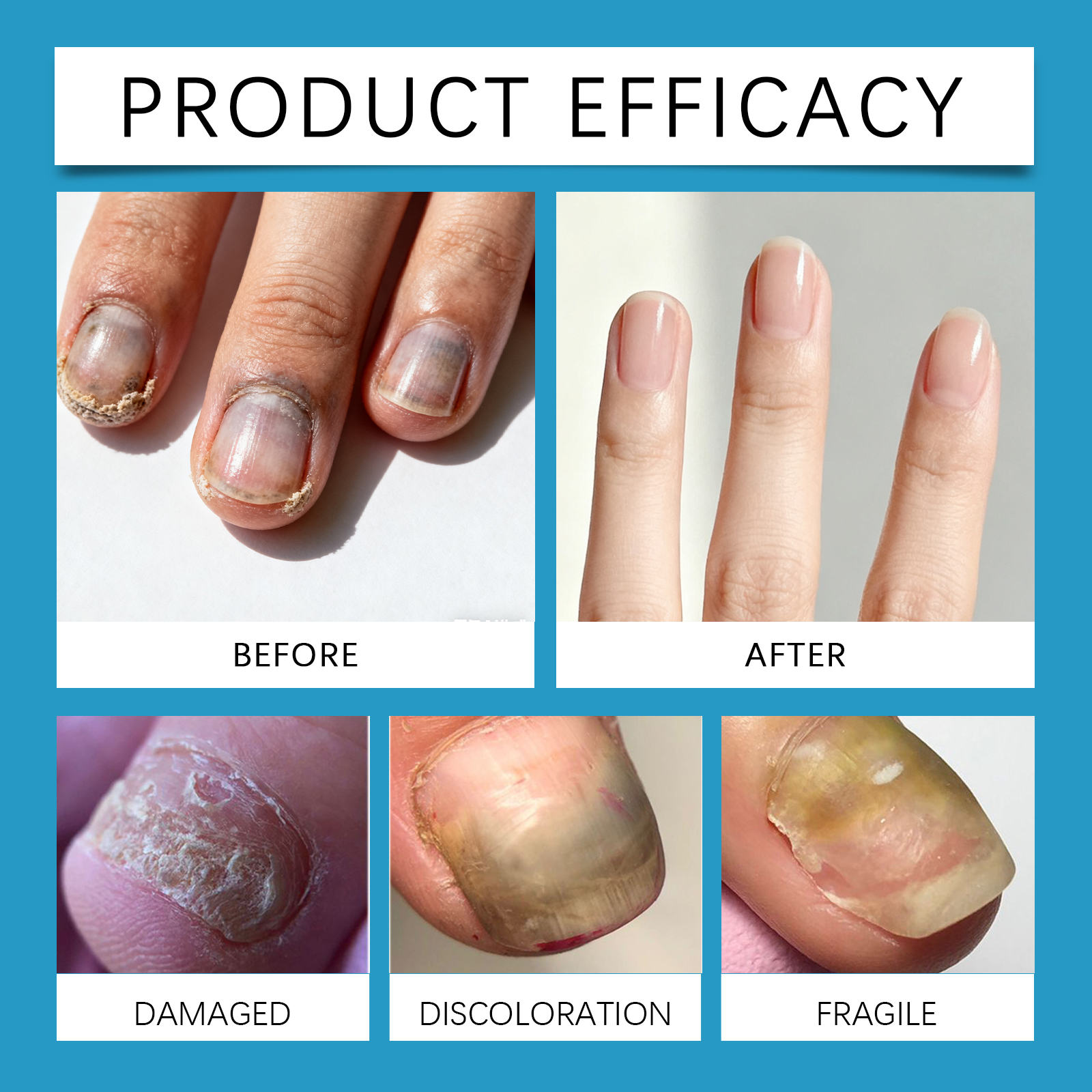 Nail Care Cream Mild Moisturizing Bright Glossy Hand Foot Daily Clean Smear Protect Skin