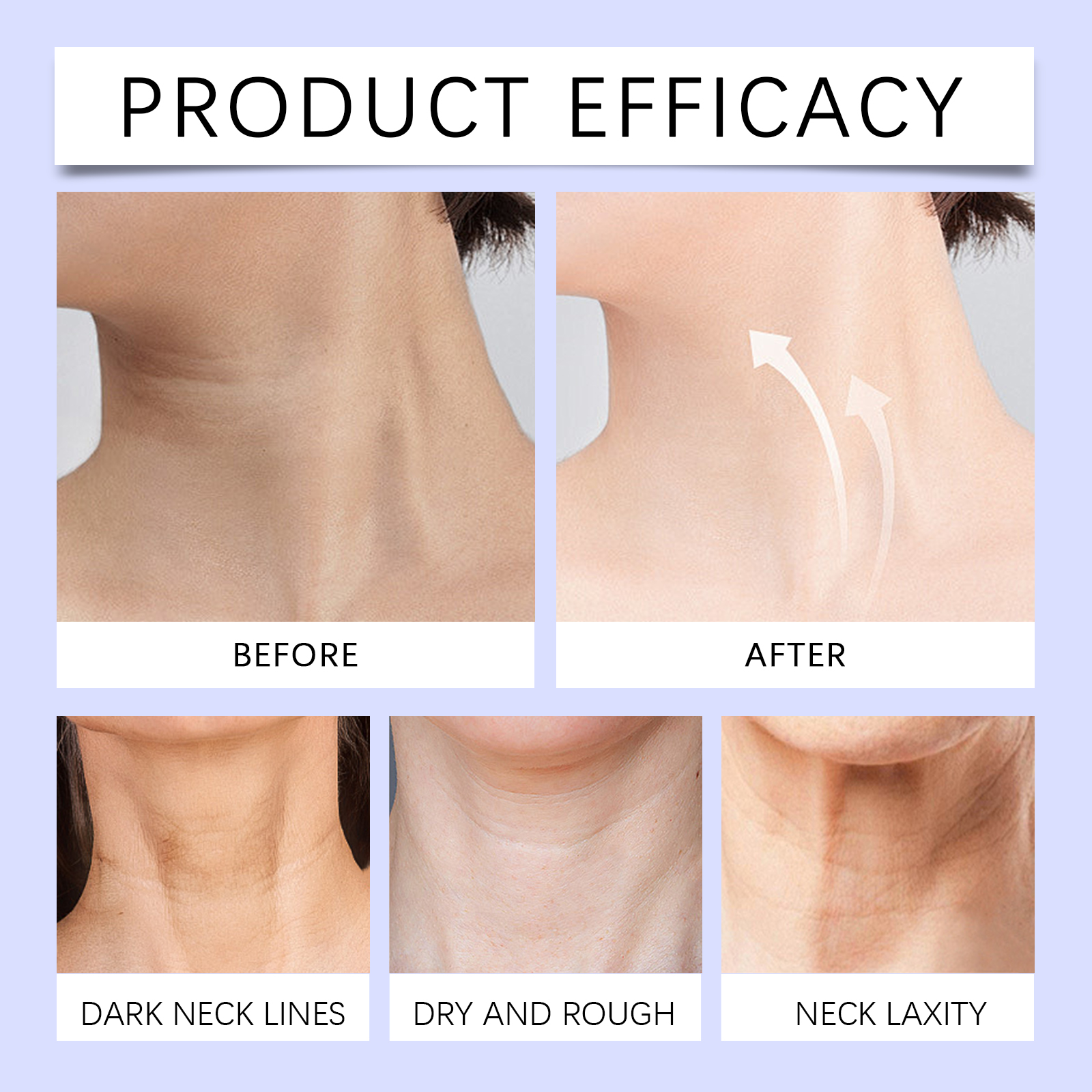 Moisturizing Neck Cream Hydrating Firming Fine Lines Daily Neck Care 50g