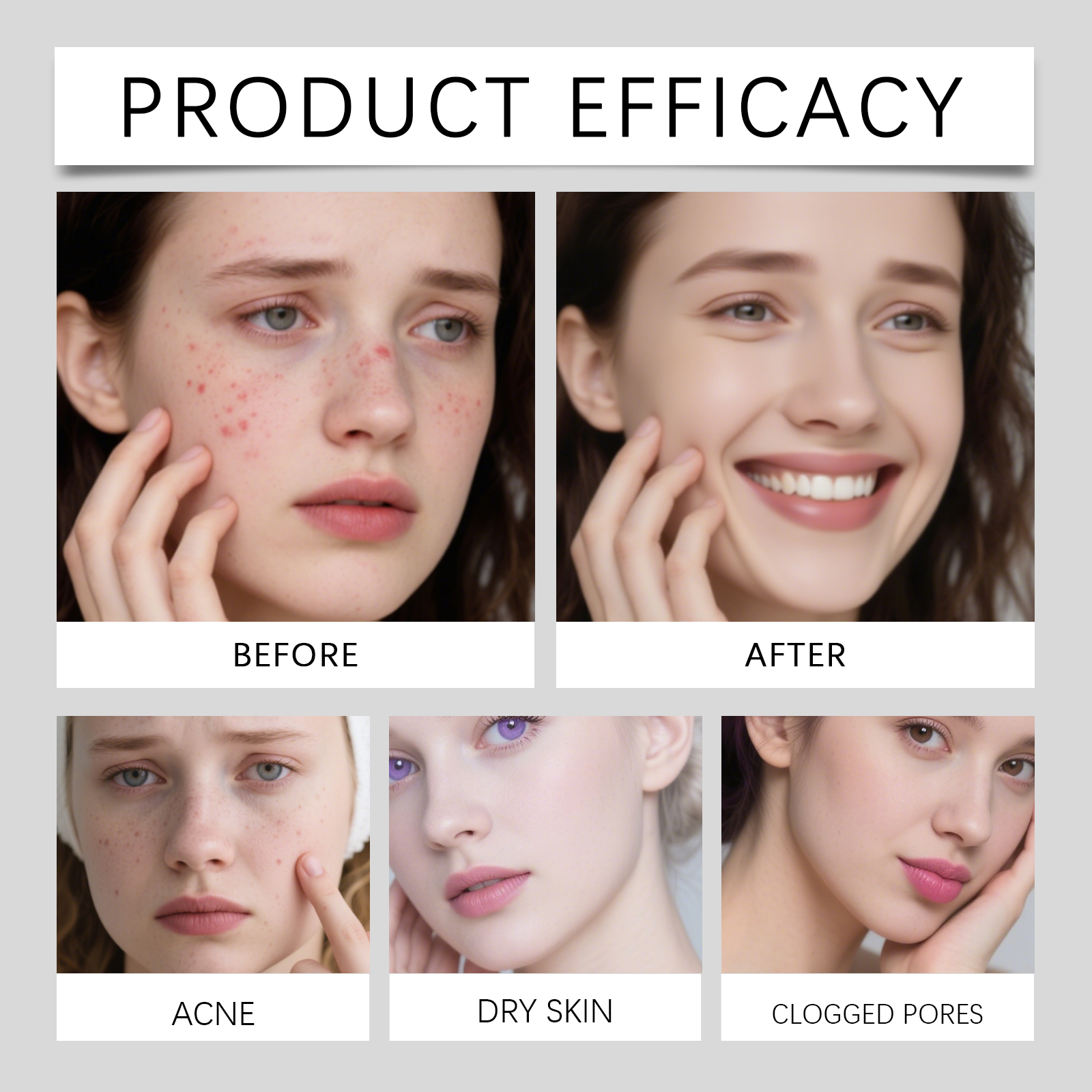 Facial Moisturizing Cream Gentle Care Skin Acne Clean Moisturizing Refreshing Nourishing Skin Friendly Delicate Skincare Lotion