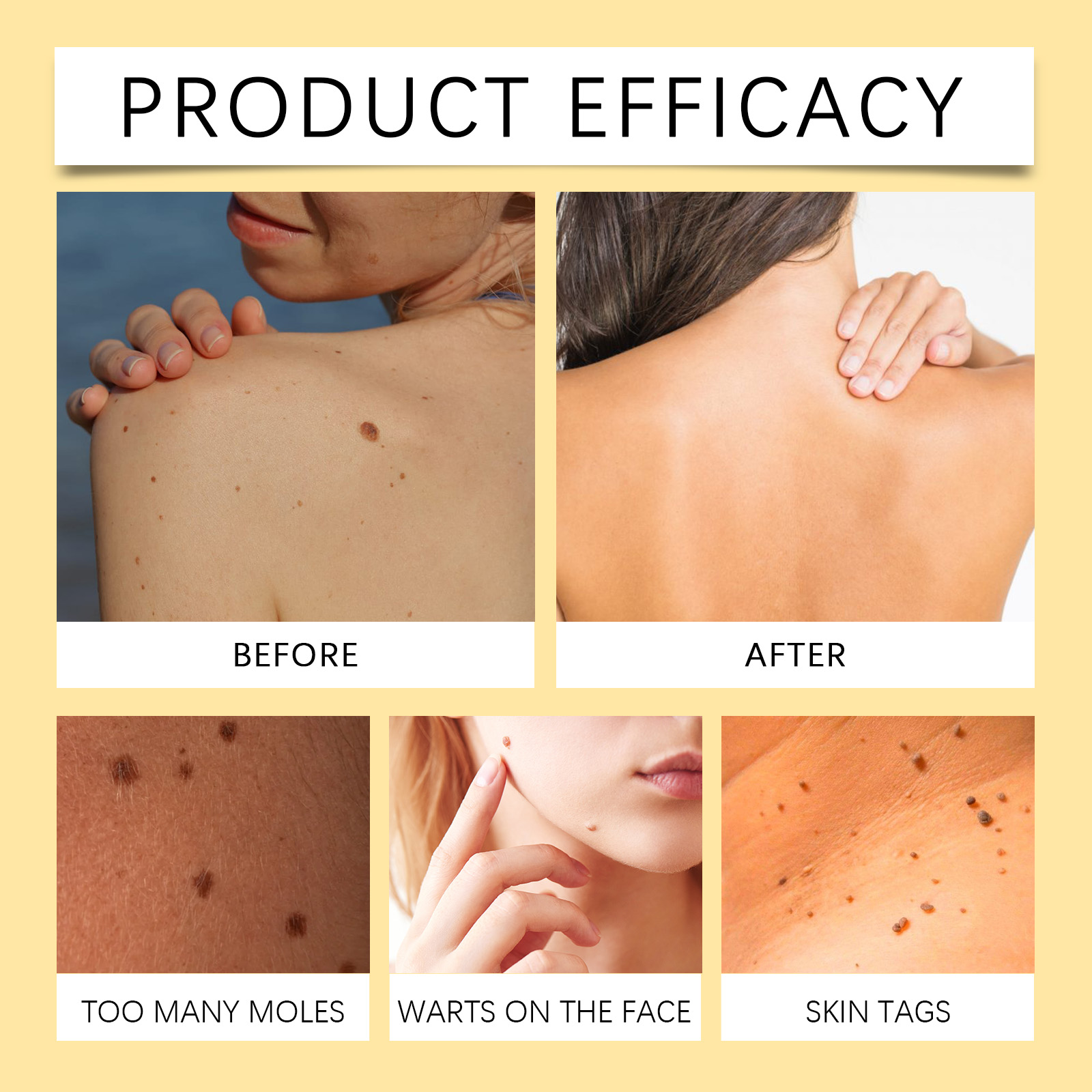 Bee Venum Skin Care Cream Body Skin Moisturizing Soft Smooth Skin Daily Cleansing Care Wart Removing Cream