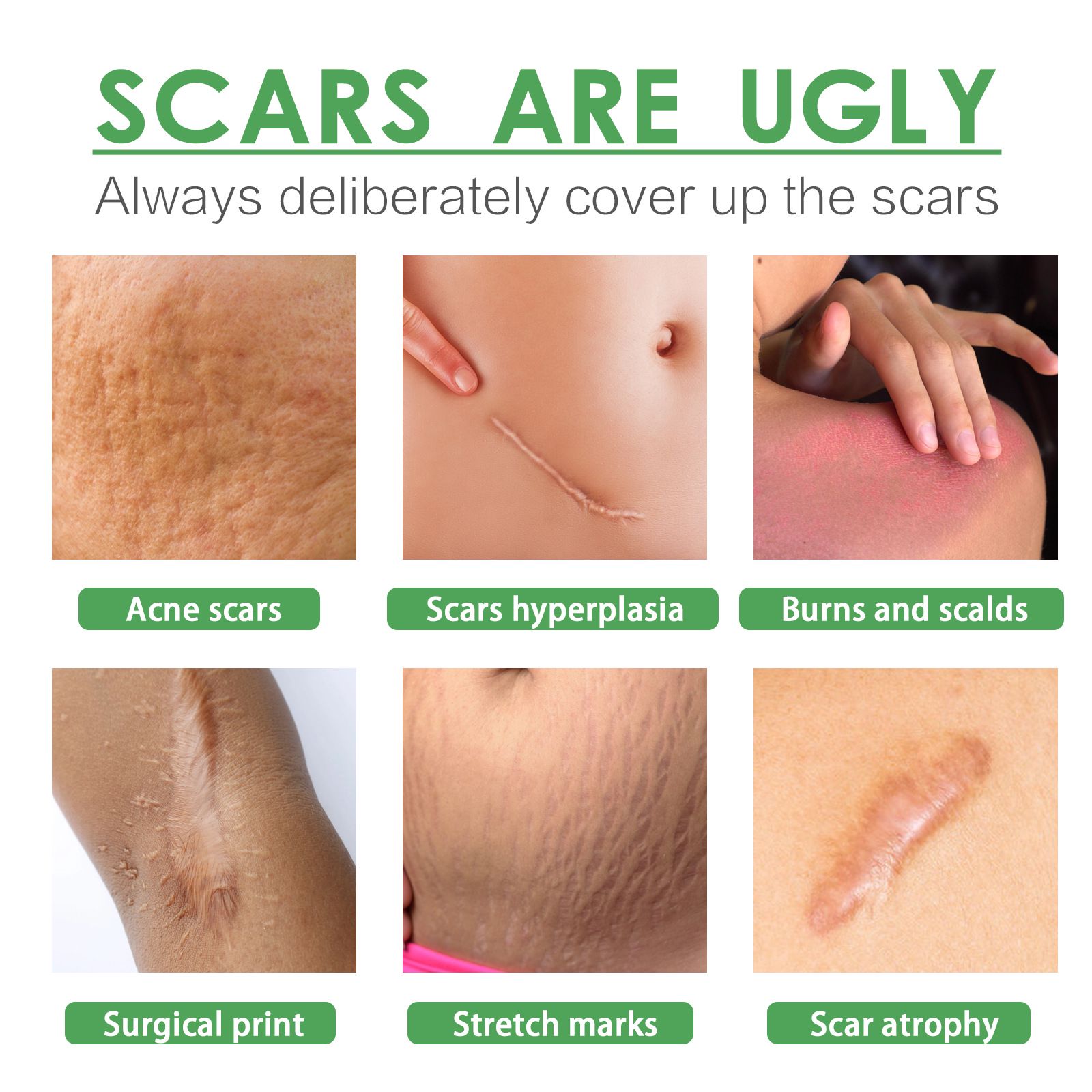 Skin Care Essence For Scar Repair Moisturizing Smoothing Body Skin Daily Use