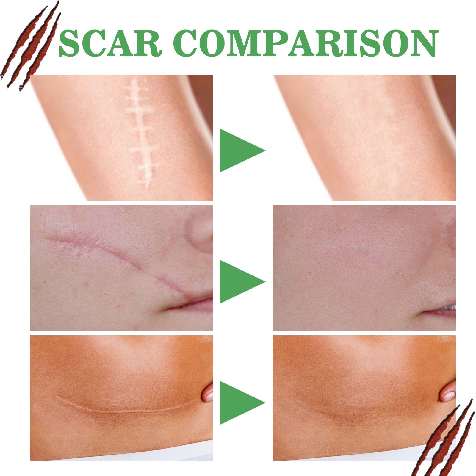 Skin Care Essence For Scar Repair Moisturizing Smoothing Body Skin Daily Use