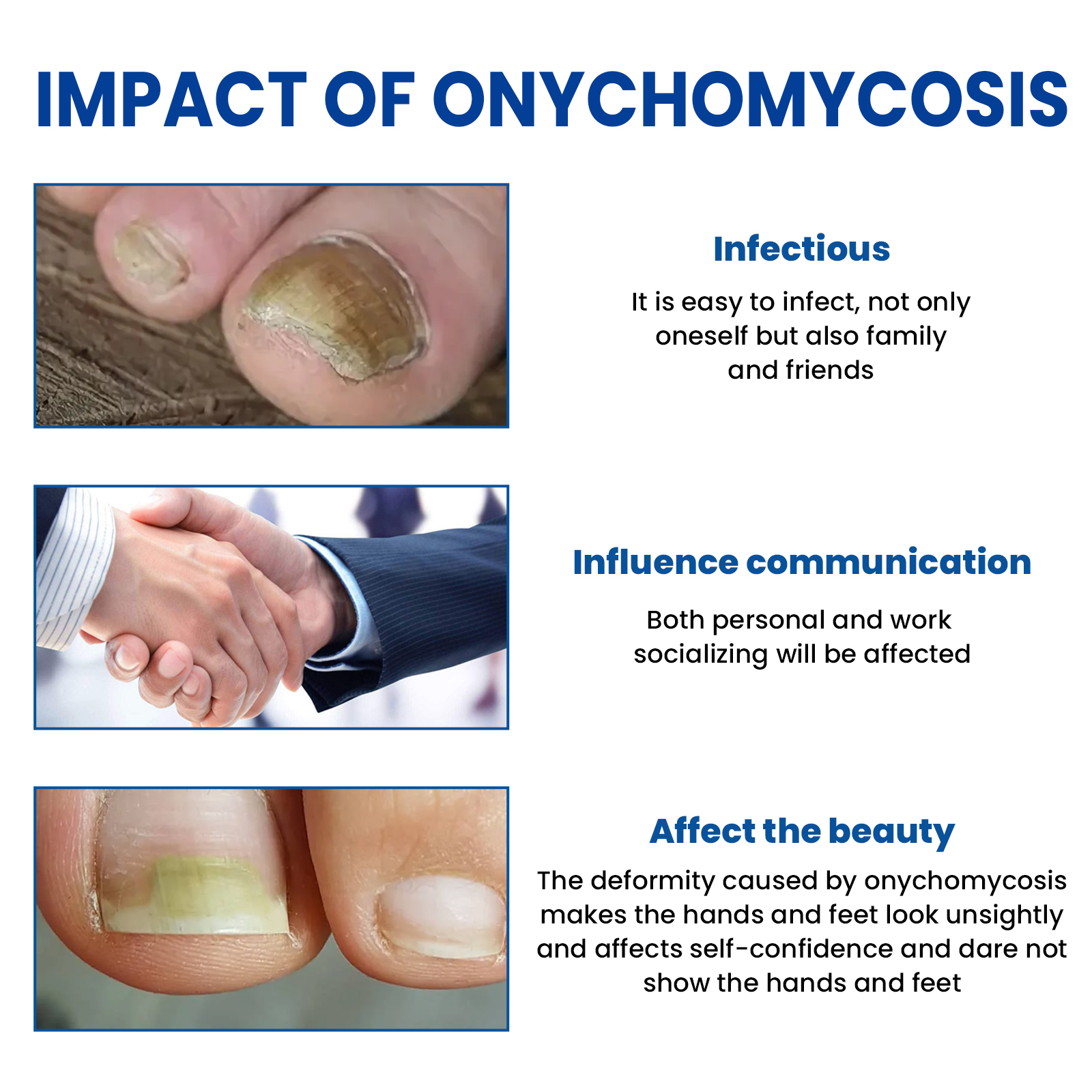 60pcs/box Paronychia Treatment Patch Fungus Removal Nail Ingrown Correction Stickers Nails Recover Pedicure Tools Health Care