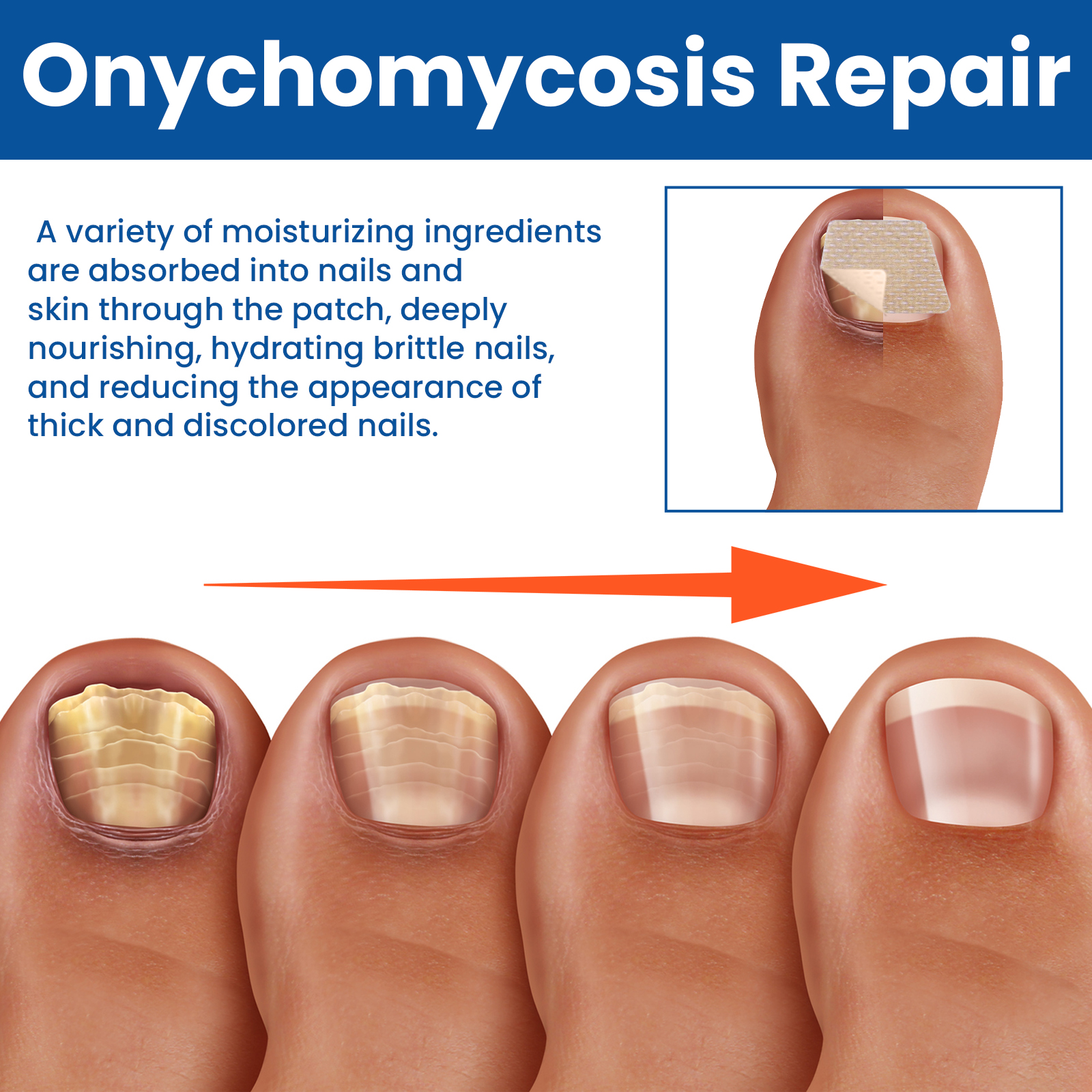 60pcs/box Paronychia Treatment Patch Fungus Removal Nail Ingrown Correction Stickers Nails Recover Pedicure Tools Health Care