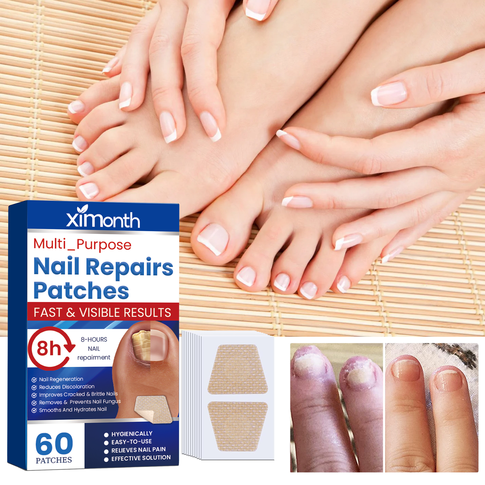 60pcs/box Paronychia Treatment Patch Fungus Removal Nail Ingrown Correction Stickers Nails Recover Pedicure Tools Health Care