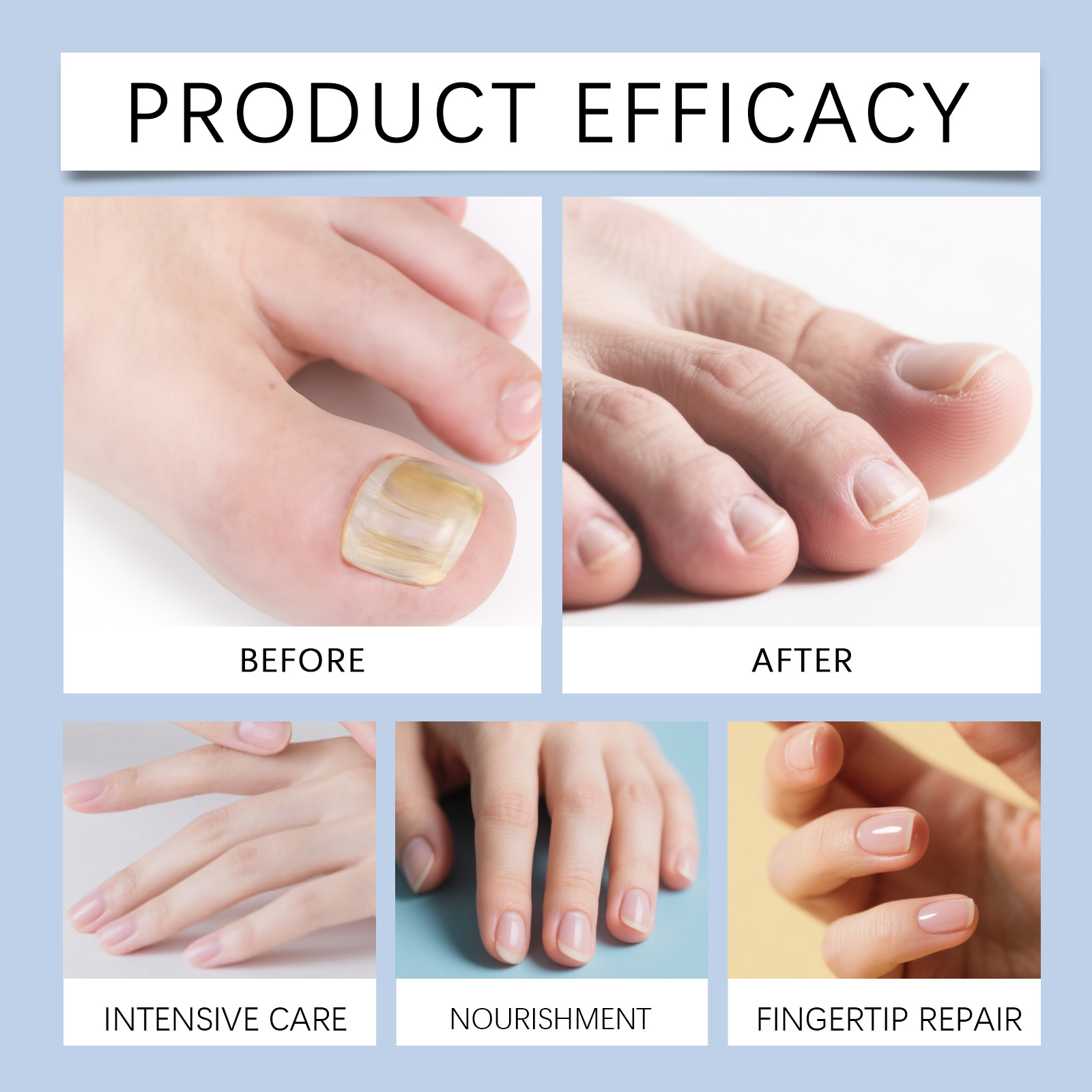 Nail Care Oil Mild Gentle Nourish Shiny Portable Daily Maintain Nail Surface