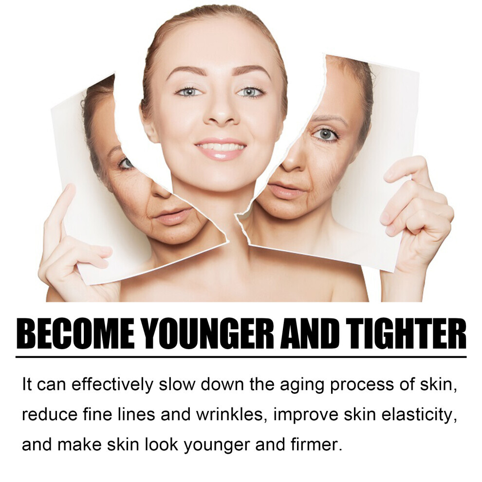 TCA Acid Skin Peel Serum - Anti-Aging Reduces Fine Lines Improves Skin Elasticity 30ml