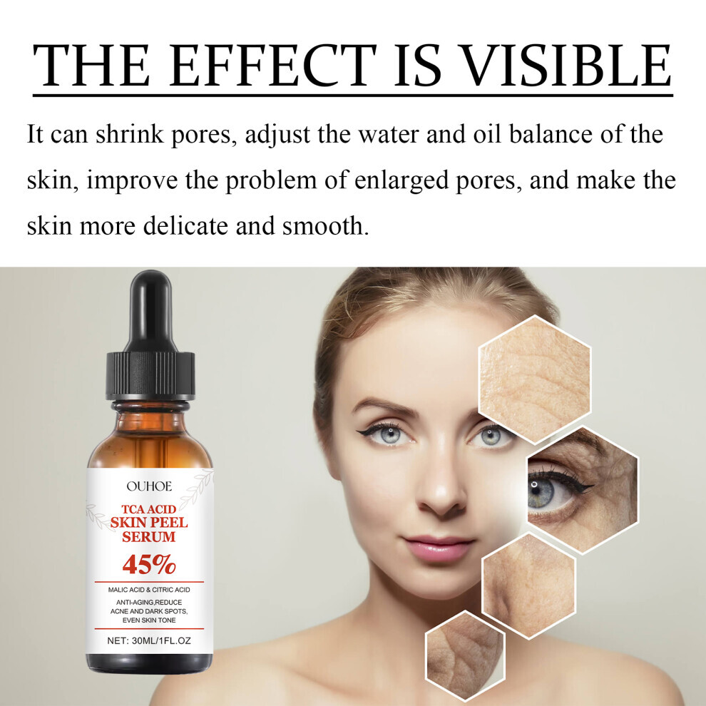 TCA Acid Skin Peel Serum - Anti-Aging Reduces Fine Lines Improves Skin Elasticity 30ml