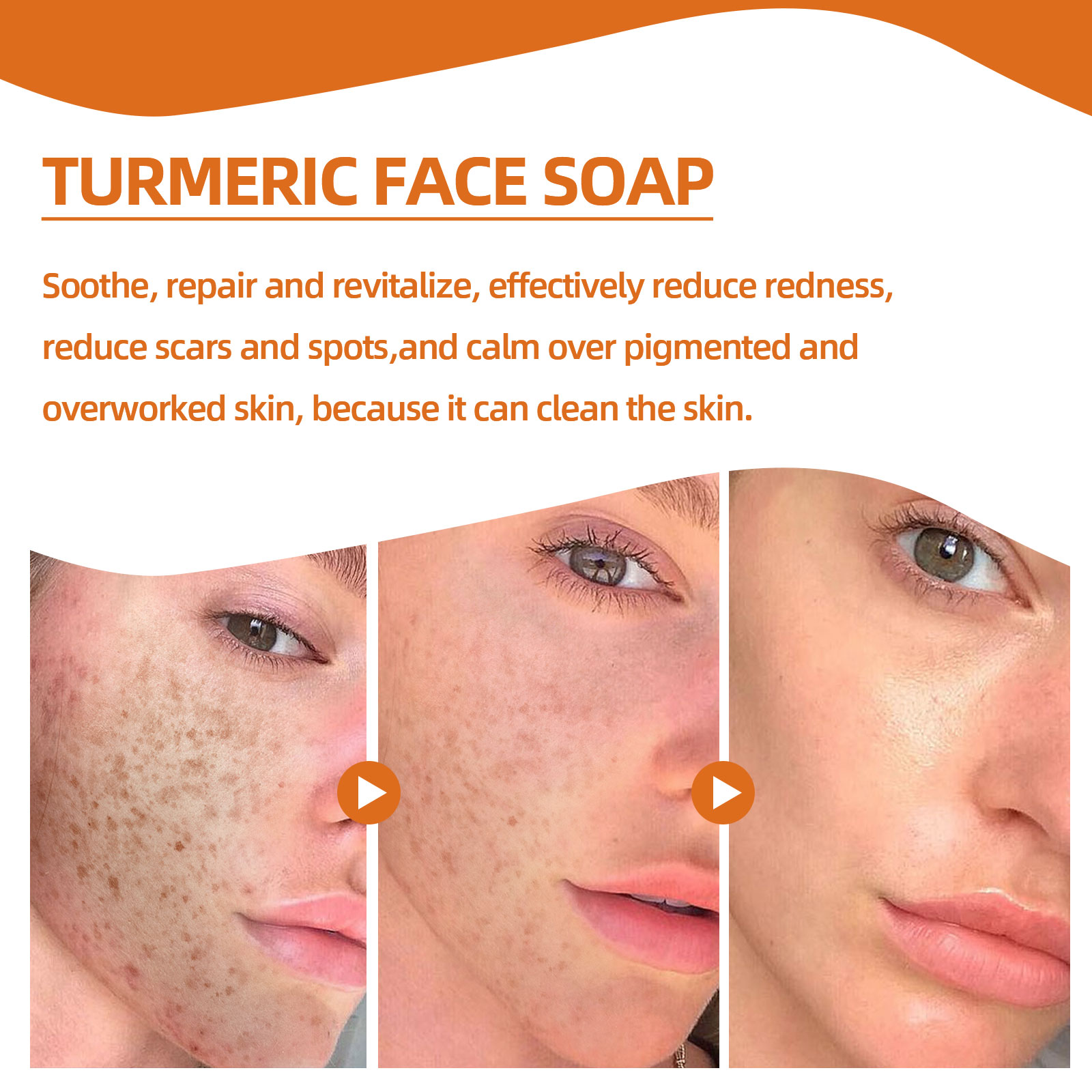 Turmeric Face Soap Gentle Cleansing Soothe Repair Even Skin Tone Daily Cleansing Bar 100g