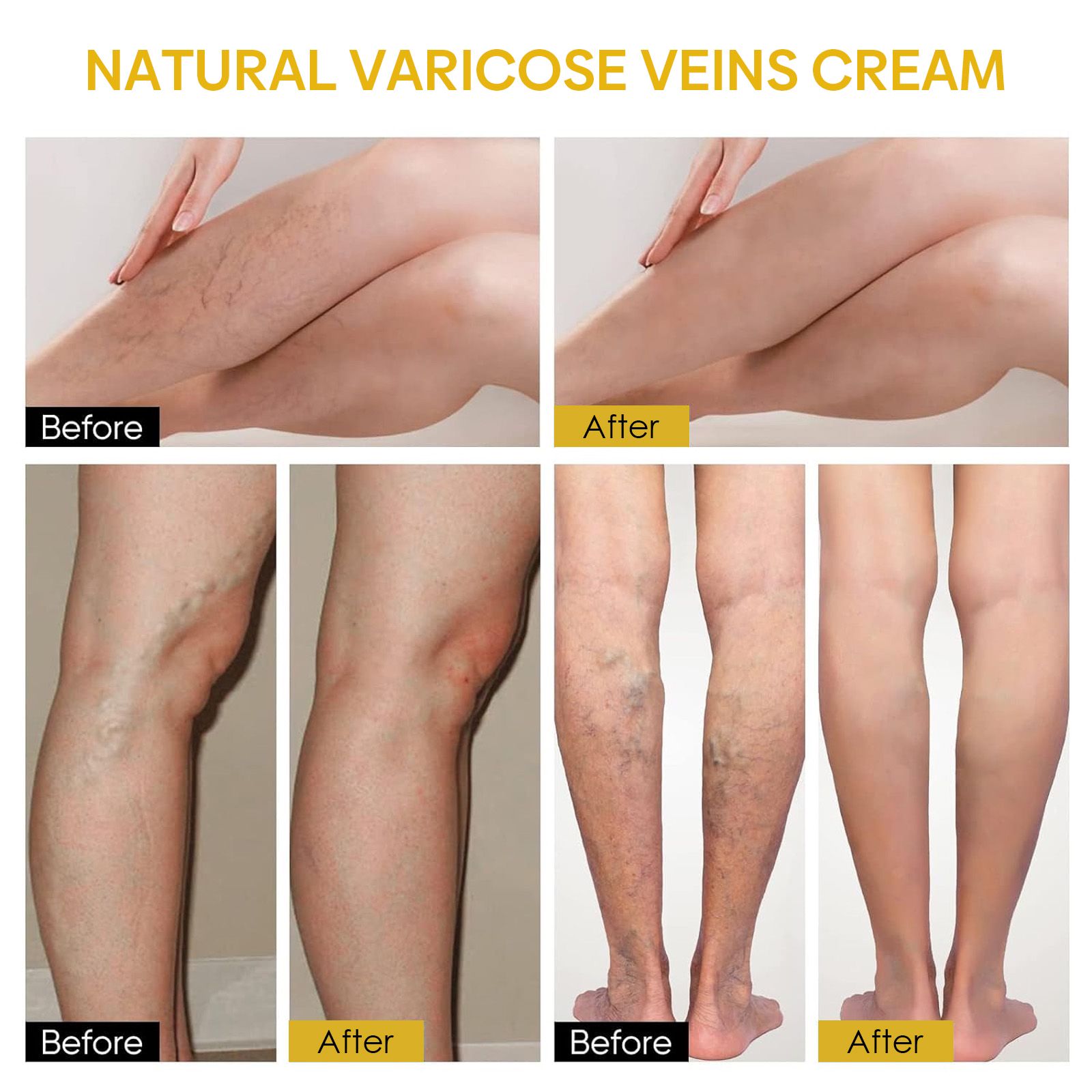 Bee Venom Leg Care Cream Soothing Moisturizing For Leg Discomfort And Daily Skin Care 60g