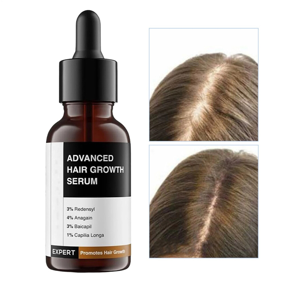 Bare Anatomy Advanced Hair Growth Serum 30ml