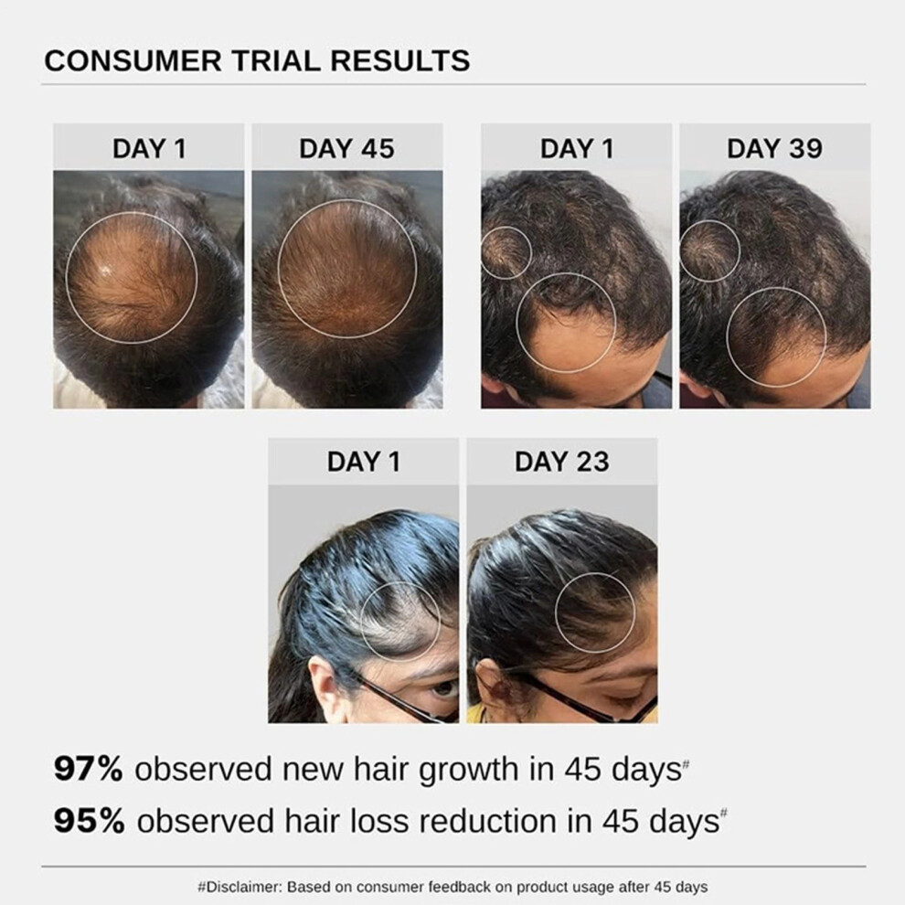 Bare Anatomy Advanced Hair Growth Serum 30ml