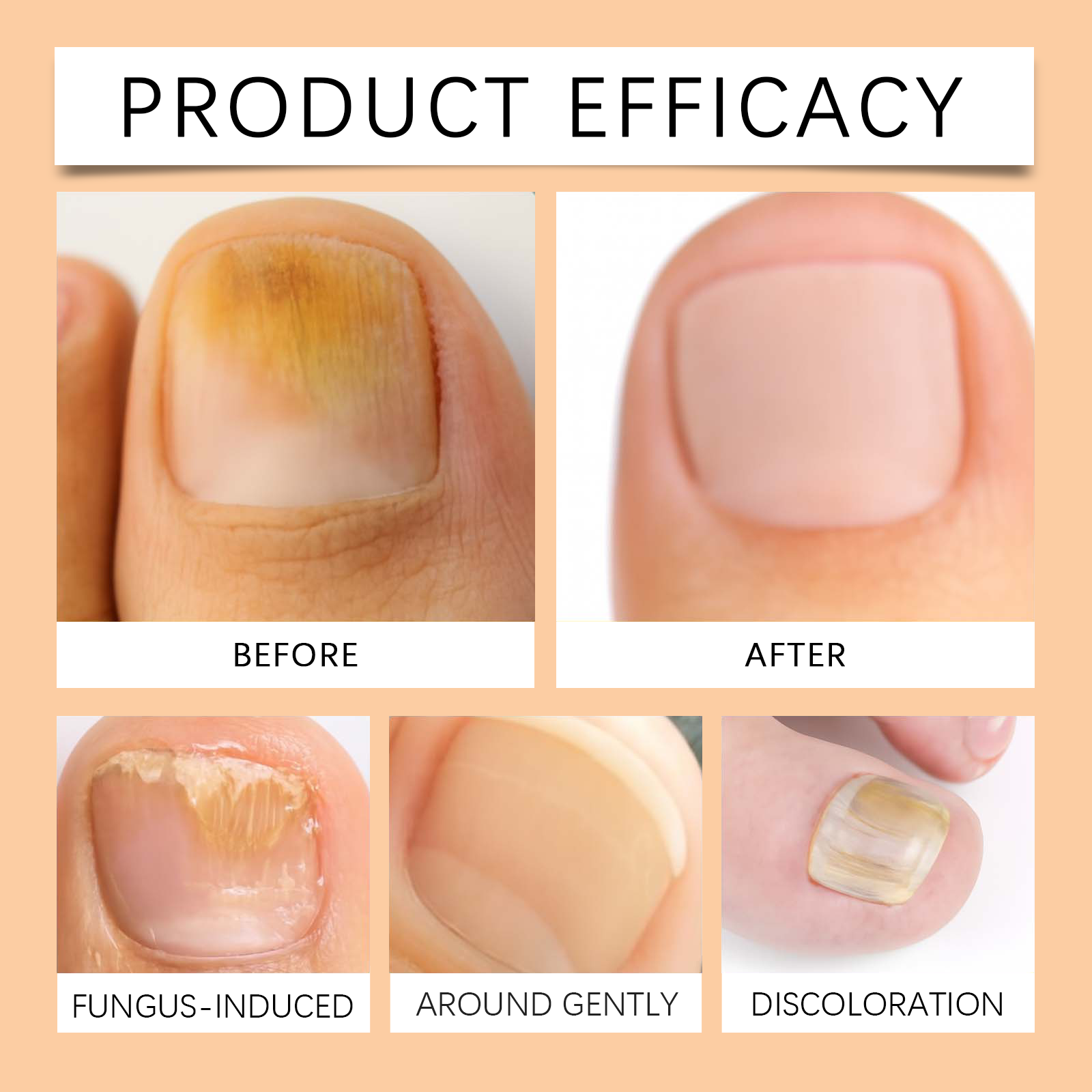 Soothe Soft Toenail Care Liquid Mild Gentle Nourish Bright Repair Hand Foot Nail Skin Daily Maintain