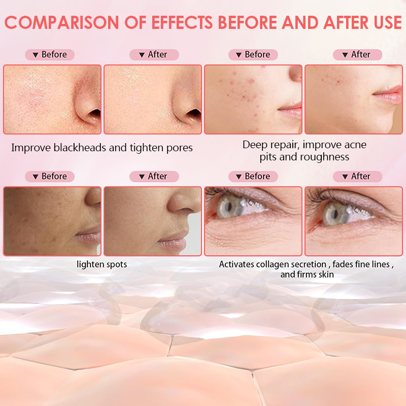 Wireless 7 Colors Face LED Mask Light Therapy Photon Facal Beauty Mask Skin Rejuvenation Anti Acne Repair Skin Tightening Anti Aging Skin Care