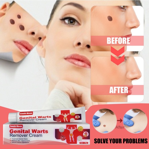 Genital Herpes Wart Remover Ointment Skin Tag Mole Cream 20g