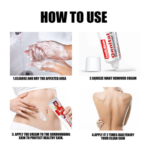 Genital Herpes Wart Remover Ointment Skin Tag Mole Cream 20g