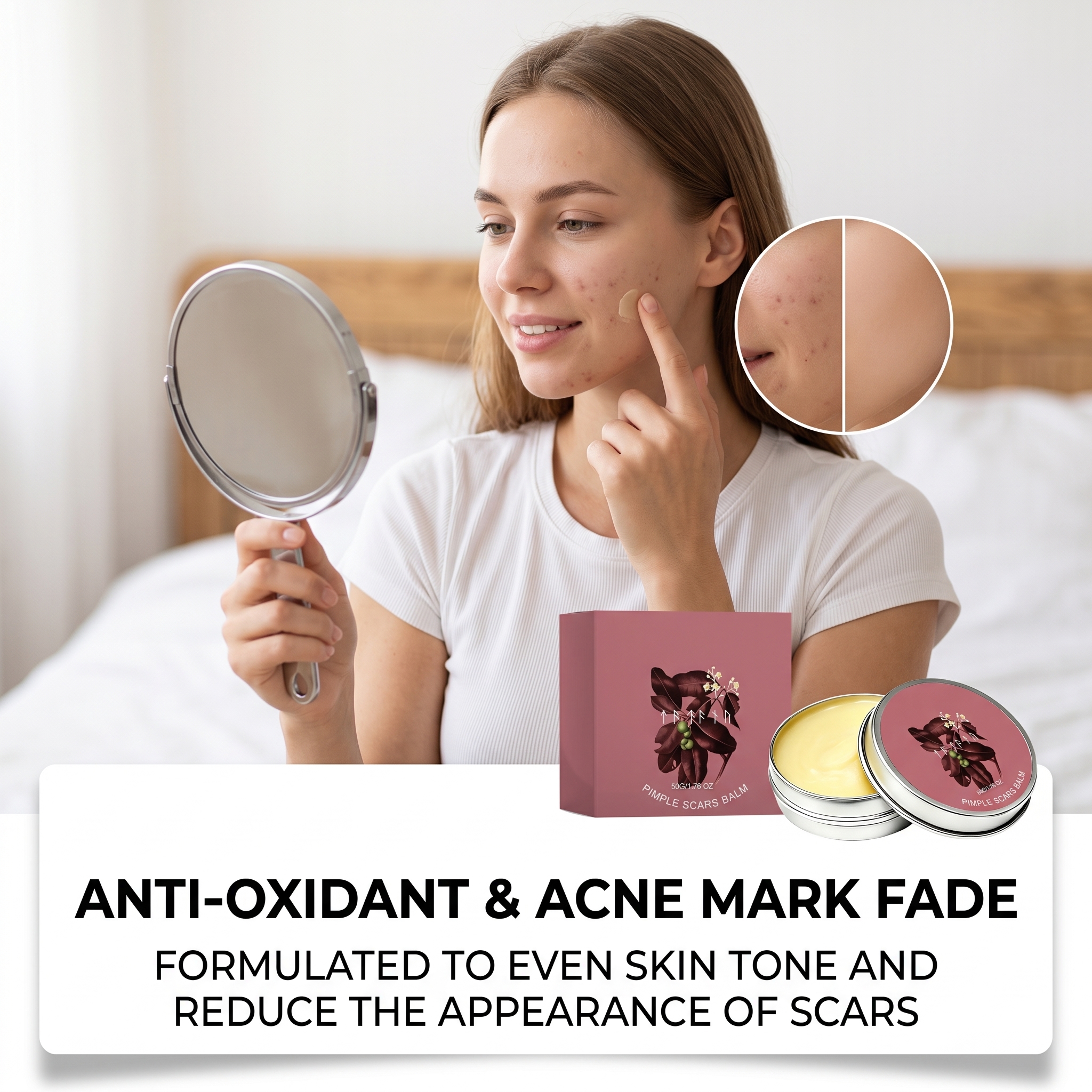 Acne Skin Ointment Herbal Plant Extract Formula Mild Moisturizing Smooth Refreshing Clean Facial Acne Skin Care