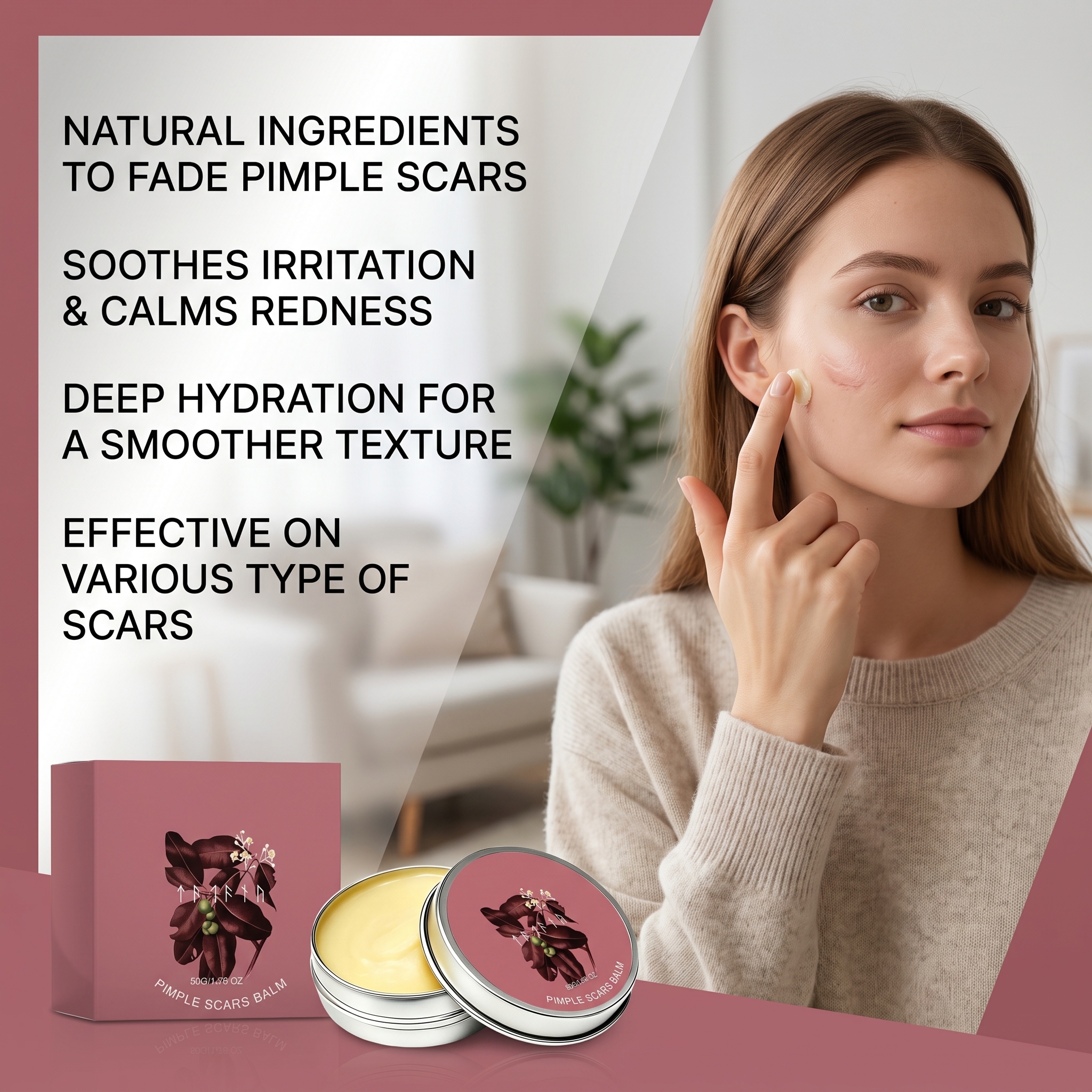 Acne Skin Ointment Herbal Plant Extract Formula Mild Moisturizing Smooth Refreshing Clean Facial Acne Skin Care